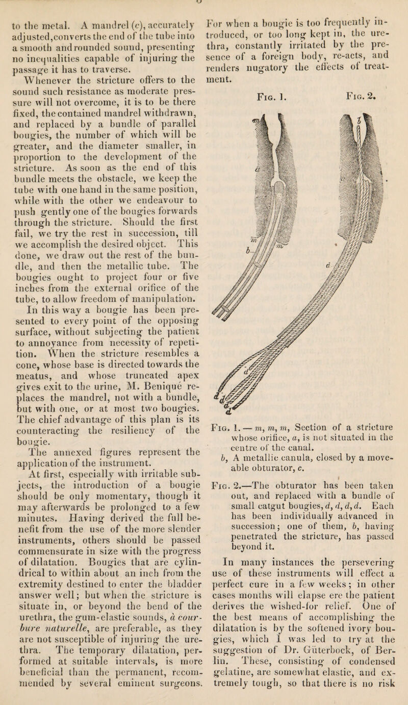 to the metal. A mandrel (c), accurately adjusted,converts the end of the tube into a smooth and rounded sound, presenting no inequalities capable of injuring the passage it has to traverse. Whenever the stricture offers to the sound such resistance as moderate pres¬ sure will not overcome, it is to be there fixed, the contained mandrel withdrawn, and replaced by a bundle of parallel bougies, the number of which will be greater, and the diameter smaller, in proportion to the development of the stricture. As soon as the end of this bundle meets the obstacle, we keep the tube with one hand in the same position, while with the other we endeavour to push gently one of the bougies forwards through the stricture. Should the first fail, we try the rest in succession, till we accomplish the desired object. This done, we draw out the rest of the bun¬ dle, and then the metallic tube. The bougies ought to project four or five inches from the external orifice of the tube, to allow freedom of manipulation. In this way a bougie has been pre¬ sented to every point of the opposing surface, without subjecting the patient to annoyance from necessity of repeti¬ tion. When the stricture resembles a cone, whose base is directed towards the meatus, and whose truncated apex gives exit to the urine, M. Benique re¬ places the mandrel, not with a bundle, but with one, or at most two bougies. The chief advantage of this plan is its counteracting the resiliency of the bougie. The annexed figures represent the application of the instrument. At first, especially with irritable sub¬ jects, the introduction of a bougie should be only momentary, though it may afterwards be prolonged to a few minutes. Having derived the full be¬ nefit from the use of the more slender instruments, others should be passed commensurate in size with the progress of dilatation. Bougies that are cylin¬ drical to within about an inch from the extremity destined to enter the bladder answer well; but when the stricture is situate in, or beyond the bend of the urethra, the gum-elastic sounds, a cour- bure naturelle, are preferable, as they are not susceptible of injuring the ure¬ thra. The temporary dilatation, per¬ formed at suitable intervals, is more beneficial than the permanent, recom¬ mended by several eminent surgeons. For when a bougie is too frequently in¬ troduced, or too long kept in, the ure¬ thra, constantly irritated by the pre¬ sence of a foreign body, re-acts, and renders nugatory the effects of treat¬ ment. Fig. 1. Fig. 2. Fig. 1. — to, to, to, Section of a stricture whose orifice, a, is not situated in the centre of the canal. b, A metallic canula, closed by a move- able obturator, c. t Fig. 2.—The obturator has been taken out, and replaced with a bundle of small catgut bougies,d,d,d,d. Each has been individually advanced in succession; one of them, b, having penetrated the stricture, has passed beyond it. In many instances the persevering use of these instruments will effect a perfect cure in a few weeks; in other cases months will elapse ere the patient derives the wished-for relief. One of the best means of accomplishing the dilatation is by the softened ivory bou¬ gies, which 1 w-as led to try at the suggestion of Dr. Giiterbock, of Ber¬ lin. These, consisting of condensed gelatine, are somewhat elastic, and ex¬ tremely tough, so that there is no risk