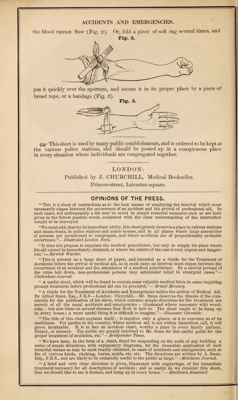 the blood cannot flow (Fig. 2). Or, fold a piece of soft rag several times, and Fig. 2. put it quickly over the aperture, and secure it in its proper place by a piece of broad tape, or a bandage (Fig. 3). Fig. 3. This sheet is used by many public establishments, and is ordered to be kept at the various police stations, ahd should be posted up in a conspicuous place in every situation where individuals are congregated together. LONDON: Published by J. CHURCHILL, Medical Bookseller, Princes-street, Leicester-square. OPINIONS OF THE PRESS. “ This is a sheet of instnictions as to the best means of employing the interval which must necessarily elapse between the occurrence of an accident and the arx’ival of professional aid. In such cases, not imfrequently a life may be saved by simple remedial measures such as are here given in the fewest possible words consistent with the clear understanding of the instruction sought to be conveyed. “We must add, that for its immediate utility, this sheet greatly deserves a place in railway stations and steam-boats, in police stations and union-houses, and in all places where large assemblies of persons are accustomed to congregate, and where accidents are of proportionably probable occurrence.”—Illustrated London News. “ It does not propose to supplant the medical practitioner, but only to supply his place where his aid cannot be immediately obtained, or where the nature of the case is very urgent and danger¬ ous.”— Berwick Warder. “ This is printed on a large sheet of paper, and intended as a G-uide for the Treatment of Accidents before the arrival of medical aid, as in most cases an interval must elapse between the occurrence of an accident and the attendance of a medical practitioner. By a careful perusal of the rules laid down, non-professional persons may administer relief in emergent cases.”— Cheltenham Journal. “ A useful sheet, which will be found to contain some valuable medical hints in cases requiring prompt treatment before professional aid can be procured.”— Bristol Mercury. “A Guide for the Treatment of Accidents and Emergencies before the arrival of Medical Aid. By Alfred Smee, Esq., F.R.S.—London: Churchill..—Mr. Smee deserves the thanks of the com¬ munity for the publication of his sheet, which contains simple directions for the treatment not merely of all the usual accidents and emergencies — illustrated where necessary with wood- cuts — but also hints on several diseases that flesh is heir to. The sheet ought to be hung up in every house; a more usefxrl thing it is difficult to imagine.”— Gloucester Chronicle. “ The title of this chart explains itself— it requires only a glance at it to conxdnce us of its usefulness. For parties in the country, where medical aid is not within immediate call, it xvill prove invaluable. It is in fact an accident chart, worthy a place in every family parlour, library, or nursery. The public are greatly indebted to Mr. Smee for this useful guide for the proper treatment of accidents, etc.”—Bridgewater Times. “ We have here, in the form of a chart, fitted for suspending on the walls of any building a series of simple directions, with explanatory diagrams, for the immediate application of such remedial means as may be most readily obtained, in cases of accidents and emergencies, such as fits of various kinds, choking, burns, scalds, etc. etc. The directions are written by A. Smee, Esq., F.R.S., and are likely to be eminently useful to the public at large.”—Maidstone Journal. “ A bi’ief and very clear direction is given, illustrated with engravings, of the immediate treatment necessary for all descriptions of accident; and so useful do we consider this sheet, that we should like to see it framed, and hung up in every house.”— Blackburn Standard.