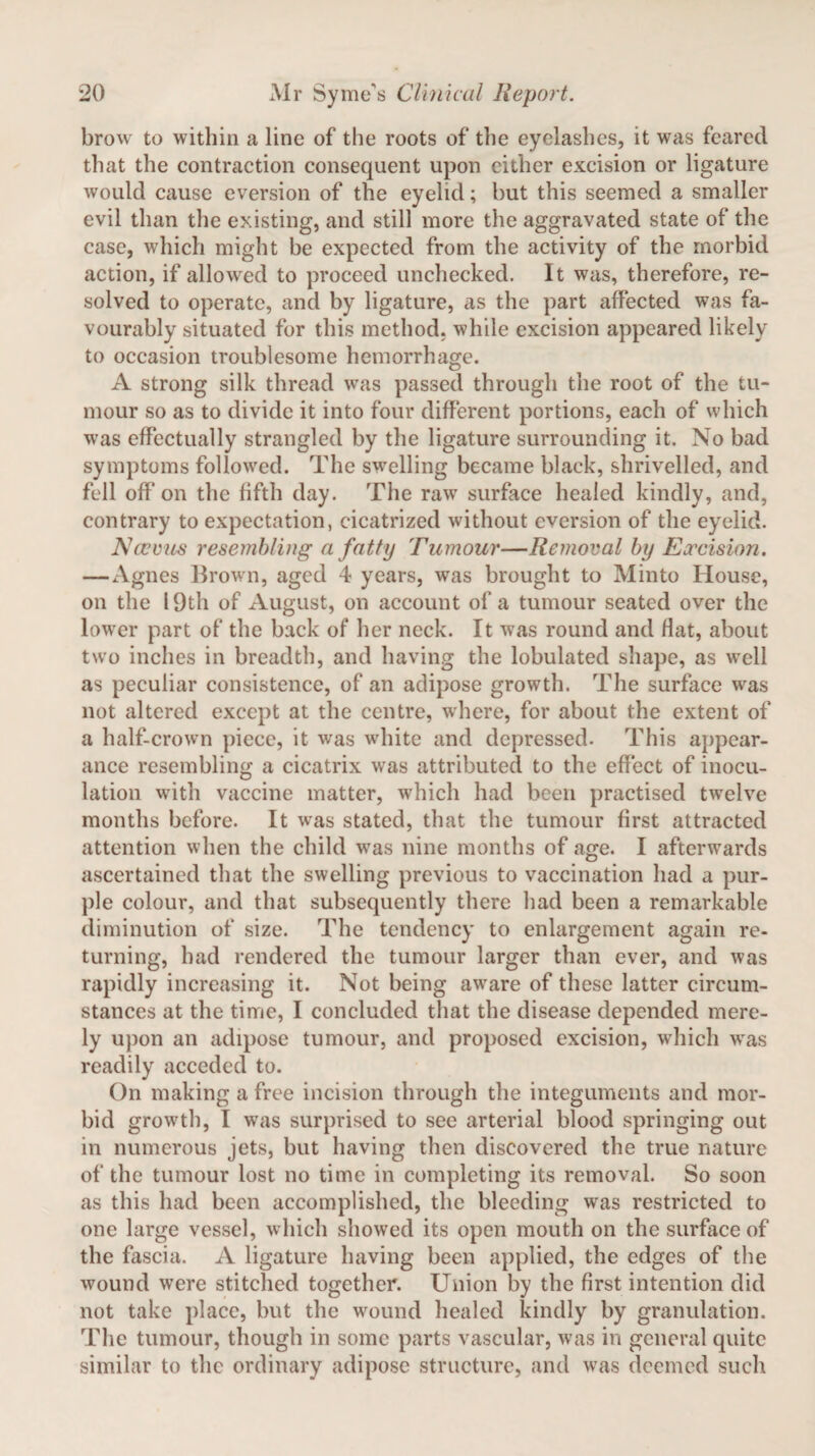 brow to within a line of the roots of the eyelashes, it was feared that the contraction consequent upon cither excision or ligature would cause eversion of the eyelid; but this seemed a smaller evil than the existing, and still more the aggravated state of the case, which might be expected from the activity of the morbid action, if allowed to proceed unchecked. It was, therefore, re¬ solved to operate, and by ligature, as the part affected was fa¬ vourably situated for this method, while excision appeared likely to occasion troublesome hemorrhage. A strong silk thread was passed through the root of the tu¬ mour so as to divide it into four different portions, each of which was effectually strangled by the ligature surrounding it. No bad symptoms followed. The swelling became black, shrivelled, and fell off on the fifth day. The raw surface healed kindly, and, contrary to expectation, cicatrized without eversion of the eyelid. Neemes resembling a fatty Tumour—Removal by Excision. —Agnes Brown, aged 4 years, was brought to Minto House, on the 19th of August, on account of a tumour seated over the lower part of the back of her neck. It was round and Hat, about two inches in breadth, and having the lobulated shape, as wrell as peculiar consistence, of an adipose growth. The surface was not altered except at the centre, where, for about the extent of a half-crown piece, it was white and depressed. This appear¬ ance resembling a cicatrix was attributed to the effect of inocu¬ lation with vaccine matter, which had been practised twrelve months before. It was stated, that the tumour first attracted attention when the child was nine months of age. I afterwards ascertained that the swelling previous to vaccination had a pur¬ ple colour, and that subsequently there had been a remarkable diminution of size. The tendency to enlargement again re¬ turning, had rendered the tumour larger than ever, and was rapidly increasing it. Not being aware of these latter circum¬ stances at the time, I concluded that the disease depended mere¬ ly upon an adipose tumour, and proposed excision, which was readily acceded to. On making a free incision through the integuments and mor¬ bid growth, I was surprised to see arterial blood springing out in numerous jets, but having then discovered the true nature of the tumour lost no time in completing its removal. So soon as this had been accomplished, the bleeding was restricted to one large vessel, which showed its open mouth on the surface of the fascia. A ligature having been applied, the edges of the wound were stitched together. Union by the first intention did not take place, but the wound healed kindly by granulation. The tumour, though in some parts vascular, was in general quite similar to the ordinary adipose structure, and was deemed such