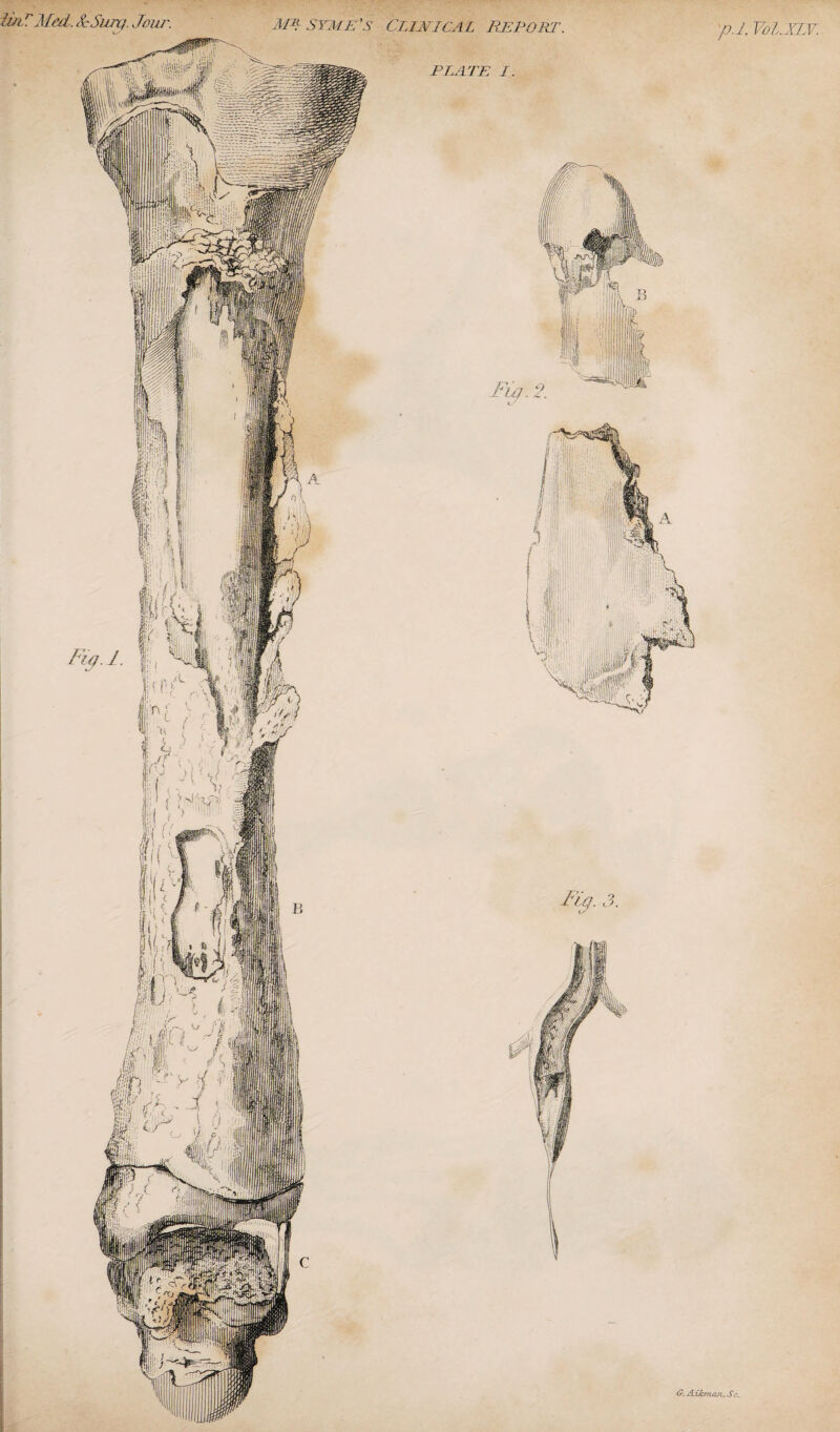 linr Med. &Sunj. Jour. PLATE I. p.l. V0I.XLV. Mir. 3. G-. AxJcmcvi, Sc.