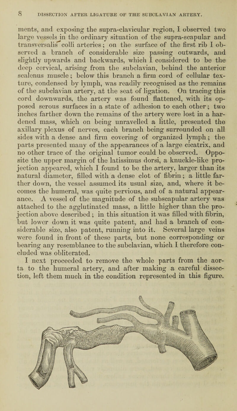 ments, and exposing the supra-clavicular region, I observed two large vessels in the ordinary situation of the supra-scapular and transversalis colli arteries; on the surface of the first rib I ob¬ served a branch of considerable size passing outwards, and slightly upwards and backwards, which I considered to be the deep cervical, arising from the subclavian, behind the anterior scalenus muscle; below this branch a firm cord of cellular tex¬ ture, condensed by lymph, was readily recognised as the remains of the subclavian artery, at the seat of ligation. On tracing this cord downwards, the artery was found flattened, with its op¬ posed serous surfaces in a state of adhesion to each other; two inches farther down the remains of the artery were lost in a har¬ dened mass, which on being unravelled a little, presented the axillary plexus of nerves, each branch being surrounded on all sides with a dense and firm covering of organized lymph; the parts presented many of the appearances of a large cicatrix, and no other trace of the original tumor could be observed. Oppo¬ site the upper margin of the latissimus dorsi, a knuckle-like pro¬ jection appeared, which I found to be the artery, larger than its natural diameter, filled with a dense clot of fibrin; a little far¬ ther down, the vessel assumed its usual size, and, where it be¬ comes the humeral, was quite pervious, and of a natural appear¬ ance. A vessel of the magnitude of the subscapular artery was attached to the agglutinated mass, a little higher than the pro¬ jection above described ; in this situation it was filled with fibrin, but lower down it was quite patent, and had a branch of con¬ siderable size, also patent, running into it. Several large veins were found in front of these parts, but none corresponding or bearing any resemblance to the subclavian, which I therefore con¬ cluded was obliterated. I next proceeded to remove the whole parts from the aor¬ ta to the humeral artery, and after making a careful dissec¬ tion, left them much in the condition represented in this figure.