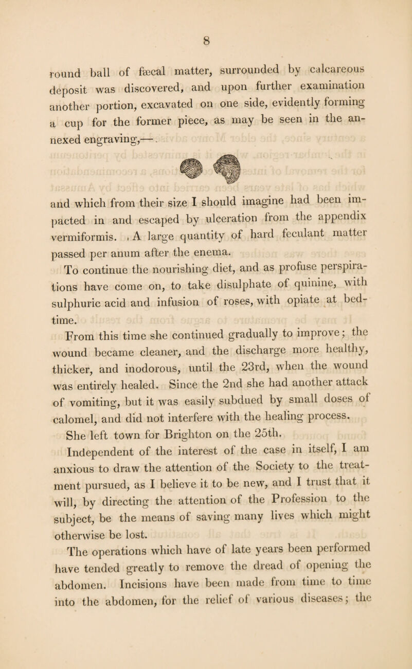 round ball of feecal matter, surrounded by calcareous deposit was discovered, and upon fuitber examination another portion, excavated on one side, evidently foiming a cup for the former piece, as may be seen in the an¬ nexed engraving,— and which from their size I should imagine had been im¬ pacted in and escaped by ulceration from the appendix vermiformis. # A large quantity of hard feculant mattei passed per anum after the enema. To continue the nourishing diet, and as profuse peispiia- tions have come on, to take disulphate ot quinine, with sulphuric acid and infusion of roses, with opiate at bed¬ time. From this time she continued gradually to improv e, the wound became cleaner, and the discharge more healthy, thicker, and inodorous, until the 23rd, when the wound was entirely healed. Since the 2nd she had another attack of vomiting, but it was easily subdued by small doses ol calomel, and did not interfere with the healing process. She left town for Brighton on the 25th. Independent of the interest of the case in itself, I am anxious to draw the attention of the Society to the treat¬ ment pursued, as I believe it to be new, and I trust that it will, by directing the attention of the Profession to the subject, be the means of saving many lives which might otherwise be lost. The operations which have of late years been performed have tended greatly to remove the dread of opening the abdomen. Incisions have been made from time to time into the abdomen, for the relief of various diseases; the