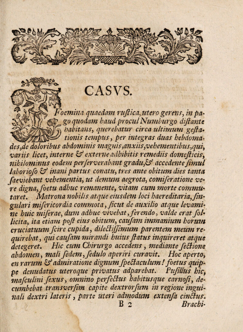 Foemina quaedam ruftica, utero geretis, in pa- |? go quodam haud proculNurnburgo dijlante \fq\ habitans, querebatur circa ultimum gefia- _ d' tionis tenipus, per integras duas hebdoma¬ des,de *doloribus abdominis magnis,anxiis,'vehementibus,qui, variis licet, interne & externe adhibitis remediis domejlicis, nihilominus eodem perferverabant gradu,& accedente Jimul laboriofo & inani partus conatu, tres ante obitum dies tanta Jaeviebant vehementia, ut demum aegrota, corniferatione ve¬ re digna, foetu adhuc remanente, vitam cum morte commu¬ taret. Matrona nobilis atque eiusdem loci haereditaria,Jin- gulari mifericordia commota, Jicut de auxilio atque levami¬ ne huic miferae, dum adhuc vivebat, ferendo, valde erat fol- licita, ita etiam poft eius obitum, caufam immanium horum cruciatuum fcire cupida, dilehlijjimum parentem meum re¬ quirebat, qui caufam mirandi huius flatus inquireret atque detegeret. Hic cum Chirurgo accedens, mediante fe£lione abdomen, mali fedem,fedulo aperiri curavit. Hoc aperto, en rarum & admiratione dignum fpettaculum ! foetus quip¬ pe denudatus uteroque privatus adparebat. PujiUus hic, mafculini fexus, omnino perferius habitusque carnoji, de¬ cumbebat transverfim capite dextrorfum in regione ingui¬ nali dextri lateris, parte uteri admodum extenfa cinftus.