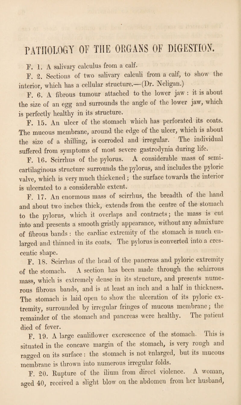 PATHOLOGY OF THE ORGANS OF DIGESTION. E. 1. A salivary calculus from a calf, 2. Sections of two salivary calculi from a calf, to show the interior, which has a cellular structure.-—(Dr. Neligan.) E. 6. A fibrous tumour attached to the lower jaw : it is about the size of an egg and surrounds the angle of the lower jaw, which is perfectly healthy in its structure. E. 15. An ulcer of the stomach which has perforated its coats. The mucous membrane, around the edge of the ulcer, which is about the size of a shilling, is corroded and irregular. The individual suffered from symptoms of most severe gastrodynia during life. E. 16. Scirrhus of the pylorus. A considerable mass of semi- cartilaginous structure surrounds the pylorus, and includes the pyloric valve, which is very much thickened; the surface towards the interior is ulcerated to a considerable extent. E. 17. An enormous mass of scirrhus, the breadth of the hand and about two inches thick, extends from the centre of the stomach to the pylorus, which it overlaps and contracts; the mass is cut into and presents a smooth gristly appearance, without any admixture of fibrous bands : the cardiac extremity of the stomach is much en¬ larged and thinned in its coats. The pylorus is converted into a cres¬ centic shape. E. 18. Scirrhus of the head of the pancreas and pyloric extremity of the stomach. A section has been made through the scliirrous mass, which is extremely dense in its structure, and presents nume¬ rous fibrous bands, and is at least an inch and a half in thickness. The stomach is laid open to show the ulceration of its pyloric ex¬ tremity, surrounded by irregular fringes of mucous membrane; the remainder of the stomach and pancreas were healthy. The patient died of fever. E. 19. A large cauliflower excrescence of the stomach. This is situated in the concave margin of the stomach, is very lough and ragged on its surface: the stomach is not enlarged, but its mucous membrane is thrown into numerous irregulai folds. E. 20. Rupture of the ilium from direct violence. A woman, aged 40, received a slight blow on the abdomen from her husband,