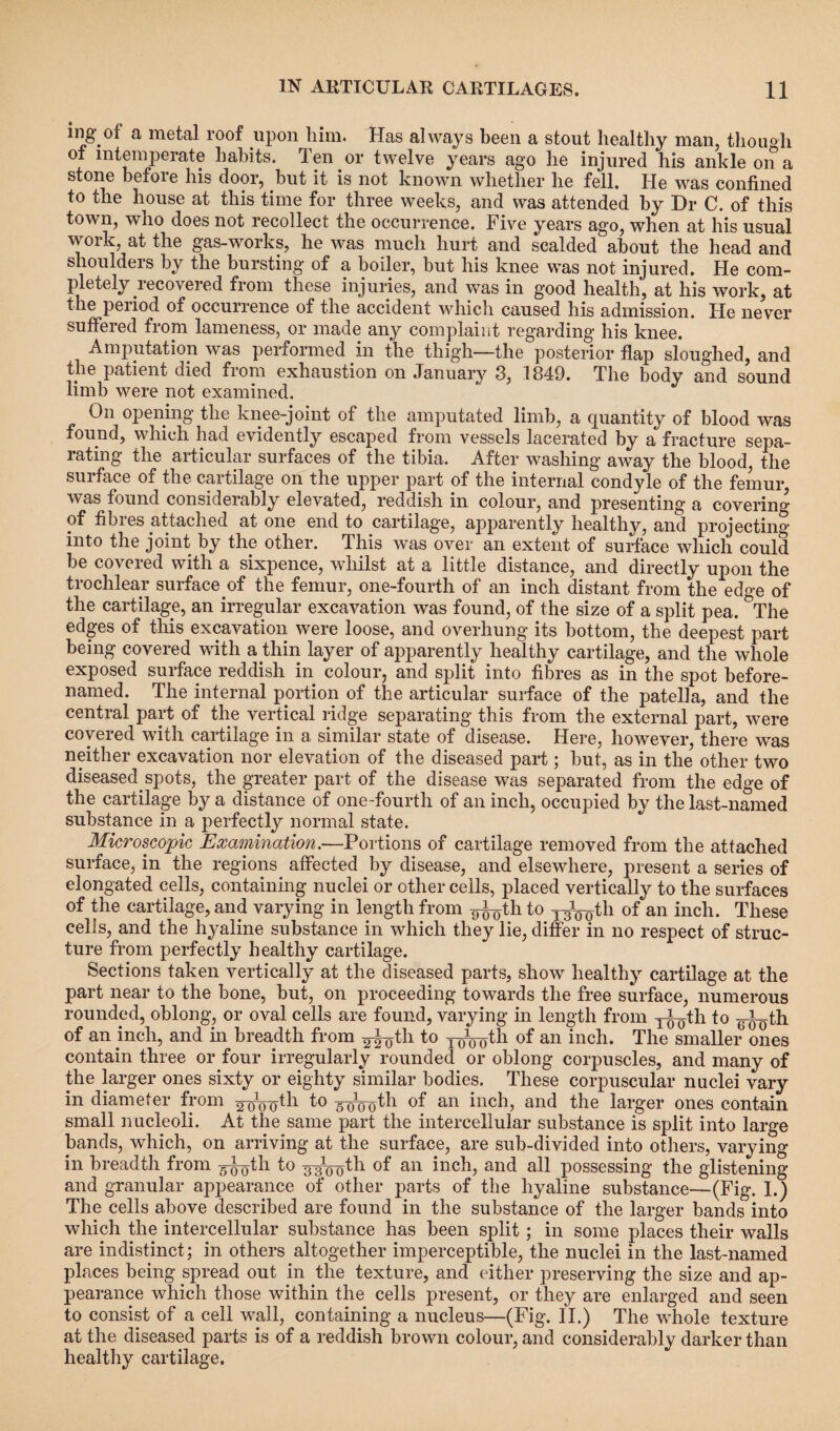 ing of a metal roof upon him. Has always been a stout healthy man, though of intemperate habits, len or twelve years ago he injured his ankle on a stone befoie his door, but it is not known whether he fell. He was confined to the house at this time for three weeks, and was attended by Dr C. of this town, who does not recollect the occurrence. Five years ago, when at his usual work, at the gas-works, he was much hurt and scalded about the head and shoulders by the bursting of a boiler, but his knee was not injured. He com¬ pletely recovered from these injuries, and was in good health, at his work, at the period of occurrence of the accident which caused his admission. He never suffered from lameness, or made any complaint regarding his knee. Amputation was performed in the thigh—the posterior flap sloughed, and the patient died from exhaustion on January 3, 1849. The body and sound limb were not examined. On opening the knee-joint of the amputated limb, a quantity of blood was found, which had evidently escaped from vessels lacerated by a fracture sepa¬ rating the articular surfaces of the tibia. After washing away the blood, the surface of the cartilage on the upper part of the internal condyle of the femur, was found considerably elevated, reddish in colour, and presenting a covering of fibres attached at one end to cartilage, apparently healthy, and projecting into the joint by the other. This was over an extent of surface which could be covered with a sixpence, whilst at a little distance, and directly upon the trochlear surface of the femur, one-fourth of an inch distant from the edge of the cartilage, an irregular excavation was found, of the size of a split pea. °The edges of this excavation were loose, and overhung its bottom, the deepest part being covered with a thin layer of apparently healthy cartilage, and the whole exposed surface reddish in colour, and split into fibres as in the spot before- named. The internal portion of the articular surface of the patella, and the central part of the vertical ridge separating this from the external part, were covered with cartilage in a similar state of disease. Here, however, there was neither excavation nor elevation of the diseased part; but, as in the other two diseased spots, the greater part of the disease was separated from the edge of the cartilage by a distance of one-fourth of an inch, occupied by the last-named substance in a perfectly normal state. Microscopic Examination.—Portions of cartilage removed from the attached surface, in the regions affected by disease, and elsewhere, present a series of elongated cells, containing nuclei or other cells, placed vertically to the surfaces of the cartilage, and varying in length from ^th to y^tli of an inch. These cells, and the hyaline substance in which they lie, differ in no respect of struc¬ ture from perfectly healthy cartilage. Sections taken vertically at the diseased parts, show healthy cartilage at the part near to the bone, but, on proceeding towards the free surface, numerous rounded, oblong, or oval cells are found, varying in length from yJ-^th to ^5th of an inch, and in breadth from ^ioth to TWoth of an inch. The smaller ones contain three or four irregularly rounded or oblong corpuscles, and many of the larger ones sixty or eighty similar bodies. These corpuscular nuclei vary in diameter from 2Wooth to 5-^ooth of an inch, and the larger ones contain small nucleoli. At the same part the intercellular substance is split into large bands, which, on arriving at the surface, are sub-divided into others, varying in breadth from y^th to yyyoth of an inch, and all possessing the glistening and granular appearance of other parts of the hyaline substance—(Fig. I.) The cells above described are found in the substance of the larger bands into which the intercellular substance has been split; in some places their walls are indistinct; in others altogether imperceptible, the nuclei in the last-named places being spread out in the texture, and either preserving the size and ap¬ pearance which those within the cells present, or they are enlarged and seen to consist of a cell wall, containing a nucleus—(Fig. II.) The whole texture at the diseased parts is of a reddish brown colour, and considerably darker than healthy cartilage.