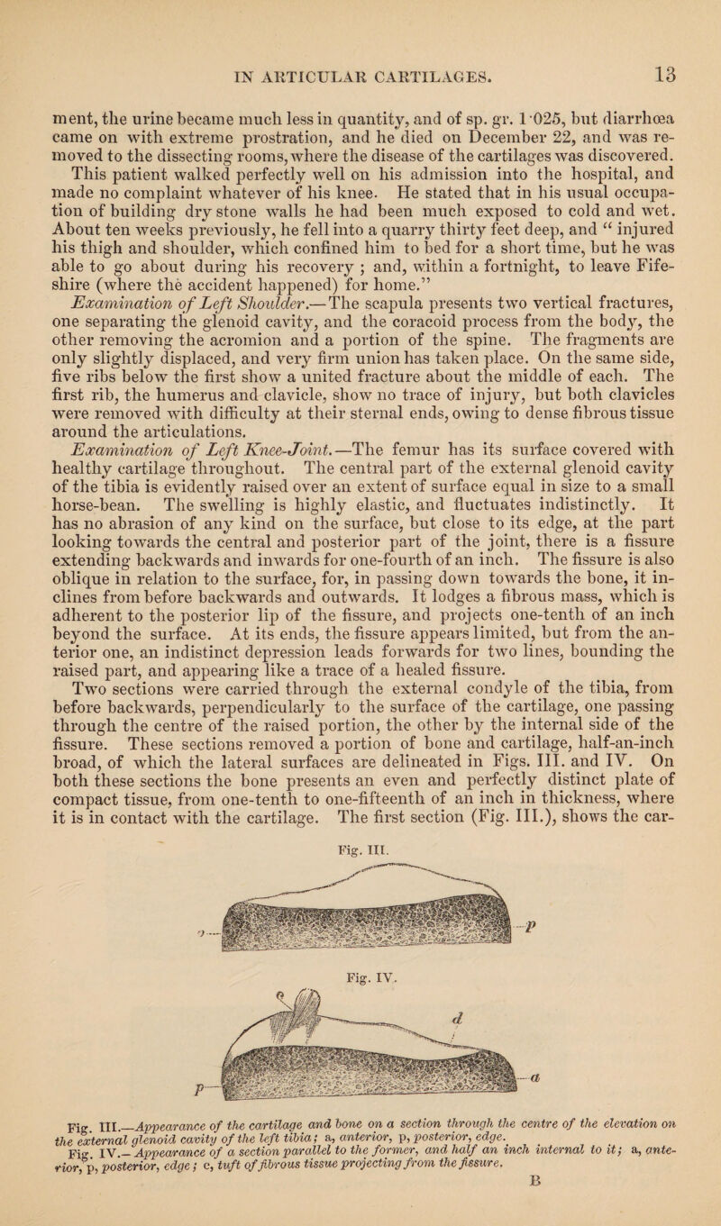 ment, the urine became much less in quantity, and of sp. gr. 1 025, but diarrhoea came on with extreme prostration, and he died on December 22, and was re¬ moved to the dissecting rooms, where the disease of the cartilages was discovered. This patient walked perfectly well on his admission into the hospital, and made no complaint whatever of his knee. He stated that in his usual occupa¬ tion of building dry stone walls he had been much exposed to cold and wet. About ten weeks previously, he fell into a quarry thirty feet deep, and “ injured his thigh and shoulder, which confined him to bed for a short time, but he was able to go about during his recovery ; and, within a fortnight, to leave Fife- shire (where the accident happened) for home.” Examination of Left Shoulder.— The scapula presents two vertical fractures, one separating the glenoid cavity, and the coracoid process from the body, the other removing the acromion and a portion of the spine. The fragments are only slightly displaced, and very firm union has taken place. On the same side, five ribs below the first show a united fracture about the middle of each. The first rib, the humerus and clavicle, show no trace of injury, but both clavicles were removed with difficulty at their sternal ends, owing to dense fibrous tissue around the articulations. Examination of Left Knee-Joint.—The femur has its surface covered with healthy cartilage throughout. The central part of the external glenoid cavity of the tibia is evidently raised over an extent of surface equal in size to a small horse-bean. The swelling is highly elastic, and fluctuates indistinctly. It has no abrasion of any kind on the surface, but close to its edge, at the part looking towards the central and posterior part of the joint, there is a fissure extending backwards and inwards for one-fourth of an inch. The fissure is also oblique in relation to the surface, for, in passing down towards the bone, it in¬ clines from before backwards and outwards. It lodges a fibrous mass, which is adherent to the posterior lip of the fissure, and projects one-tenth of an inch beyond the surface. At its ends, the fissure appears limited, but from the an¬ terior one, an indistinct depression leads forwards for two lines, bounding the raised part, and appearing like a trace of a healed fissure. Two sections were carried through the external condyle of the tibia, from before backwards, perpendicularly to the surface of the cartilage, one passing through the centre of the raised portion, the other by the internal side of the fissure. These sections removed a portion of bone and cartilage, half-an-inch broad, of which the lateral surfaces are delineated in Figs. III. and IV. On both these sections the bone presents an even and perfectly distinct plate of compact tissue, from one-tenth to one-fifteenth of an inch in thickness, where it is in contact with the cartilage. The first section (Fig. III.), shows the car- Fig. III. Fig. IV. pjp. xil._Appearance of the cartilage and bone on a section through the centre of the elevation on the external glenoid cavity of the left tibia; a, anterior, p, posterior, edge. Fig IV.— Appearance of a section parallel to the former, and half an inch internal to it; a, ante¬ rior,^ posterior, edge; c, tuft of fibrous tissue projecting from the fissure, B