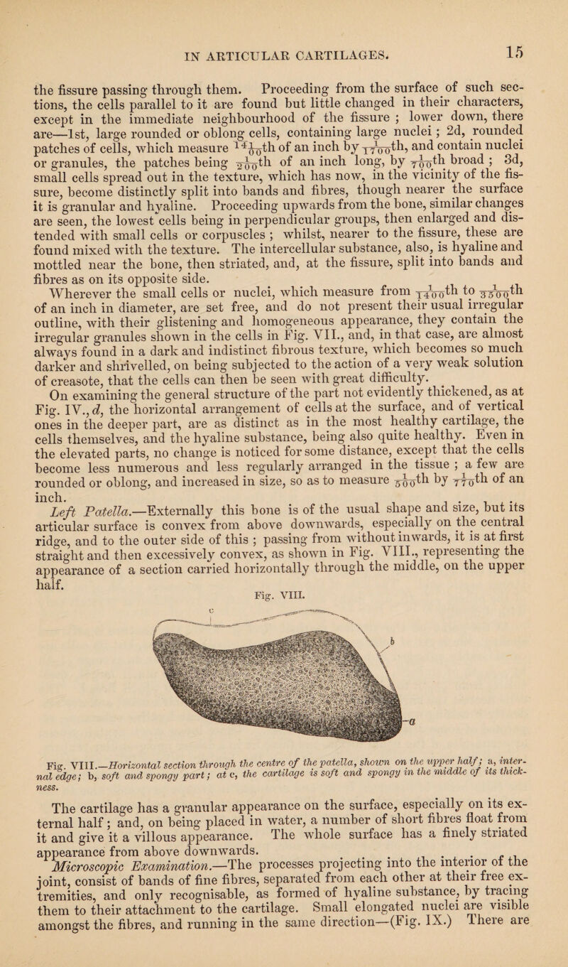 the fissure passing through them. Proceeding from the surface of such sec¬ tions, the cells parallel to it are found but little changed in their characters, except in the immediate neighbourhood of the fissure ; lower down, there are—1st, large rounded or oblong cells, containing large nuclei; 2d, rounded patches of cells, which measure 1 ?ooth of an inch by yyVoth, and contain nuclei or granules, the patches being y^oth °f an inch by •yp.th broad ; 3d, small cells spread out in the texture, which has now, in the vicinity of the fis¬ sure, become distinctly split into bands and fibres, though nearer the surface it is granular and hyaline. Proceeding upwards from the bone, similar changes are seen, the lowest cells being in perpendicular groups, then enlarged and dis¬ tended with small cells or corpuscles ; whilst, nearer to the fissure, these are found mixed with the texture. The intercellular substance, also, is hyaline and mottled near the bone, then striated, and, at the fissure, split into bands and fibres as on its opposite side. Wherever the small cells or nuclei, which measure from yyVo^1 3 voo^1 of an inch in diameter, are set free, and do not present their usual irregular outline, with their glistening and homogeneous appearance, they contain the irregular granules shown in the cells in Fig. VII., and, in that case, are almost always found in a dark and indistinct fibrous texture, which becomes so much darker and shrivelled, on being subjected to the action of a very weak solution of creasote, that the cells can then be seen with great difficulty. On examining the general structure of the part not evidently thickened, as at Fig. IV., d, the horizontal arrangement of cells at the surface, and of vertical ones in the deeper part, are as distinct as in the most healthy cartilage, the cells themselves, and the hyaline substance, being also quite healthy. Even in the elevated parts, no change is noticed for some distance, except that the cells become less numerous and less regularly arranged in the tissue ; a few are rounded or oblong, and increased in size, so as to measure yyoth by 7 7 cdh of Left Patella.—Externally this bone is of the usual shape and size, but its articular surface is convex from above downwards, especially on the cential ridge, and to the outer side of this ; passing from without inwards, it is at first straight and then excessively convex, as shown in Fig. VIII., representing the appearance of a section carried horizontally through the middle, on the upper half. Fig. VIII. Fis? VIII.—Horizontal section through the centre of the patella, shown on the upper half; a, inter- naledge; b, soft and spongy part; ate, the cartilage is soft and spongy m the middle of its thick¬ ness. The cartilage has a granular appearance on the surface, especially on its ex¬ ternal half; and, on being placed in water, a number of short fibres float from it and give it a villous appearance. The whole surface has a finely striated appearance from above downwards. . . Microscopic Examination.—The processes projecting into the interior ot the joint, consist of bands of fine fibres, separated from each other at their free ex¬ tremities, and only recognisable, as formed of hyaline substance, by tracing them to their attachment to the cartilage. Small elongated nuclei are visible amongst the fibres, and running in the same direction (Fig. IX.) Iheie are
