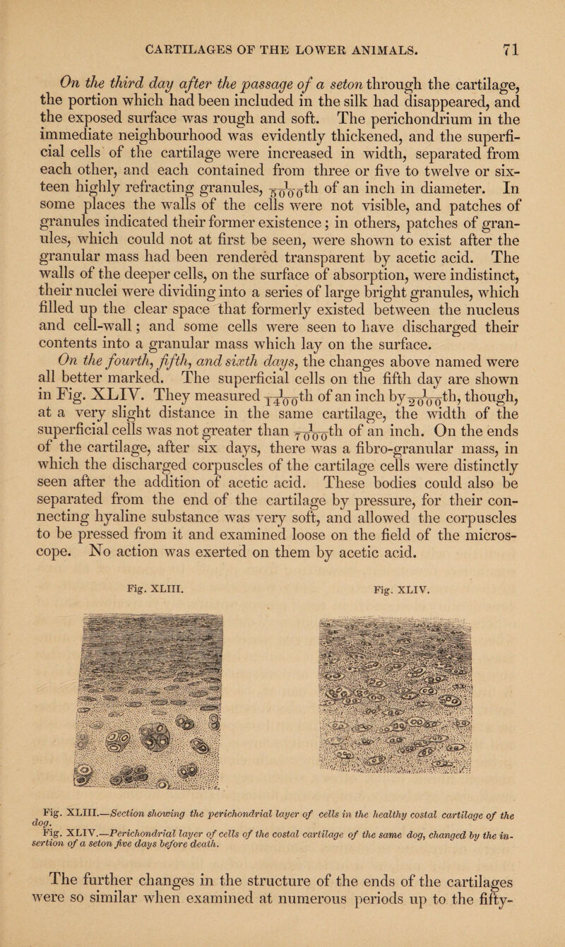 On the third day after the passage of a seton through the cartilage, the portion which had been included in the silk had disappeared, and the exposed surface was rough and soft. The perichondrium in the immediate neighbourhood was evidently thickened, and the superfi¬ cial cells of the cartilage were increased in width, separated from each other, and each contained from three or five to twelve or six¬ teen highly refracting granules, of an inch in diameter. In some places the walls of the cells were not visible, and patches of granules indicated their former existence; in others, patches of gran¬ ules, which could not at first be seen, were shown to exist after the granular mass had been rendered transparent by acetic acid. The walls of the deeper cells, on the surface of absorption, were indistinct, their nuclei were dividing into a series of large bright granules, which filled up the clear space that formerly existed between the nucleus and cell-wall; and some cells were seen to have discharged their contents into a granular mass which lay on the surface. On the fourth, fifth, and sixth days, the changes above named were all better marked. The superficial cells on the fifth day are shown in Fig. XLIY. They measured y^gth of an inch by yth, though, at a very slight distance in the same cartilage, the width of the superficial cells was not greater than yoVoth of an inch. On the ends of the cartilage, after six clays, there was a fibro-granular mass, in which the discharged corpuscles of the cartilage cells were distinctly seen after the addition of acetic acid. These bodies could also be separated from the end of the cartilage by pressure, for their con¬ necting hyaline substance was very soft, and allowed the corpuscles to be pressed from it and examined loose on the field of the micros¬ cope. No action was exerted on them by acetic acid. Fig. XLIII. Fig. XLIV. Fig. XLIII—Section showing the perichondrial layer of cells in the healthy costal cartilage of the dog. Fig. XLIV. —Perichondrial layer of cells of the costal cartilage of the same dog, changed by the in¬ sertion of a seton five days before death. The further changes in the structure of the ends of the cartilages were so similar when examined at numerous periods up to the fifty-