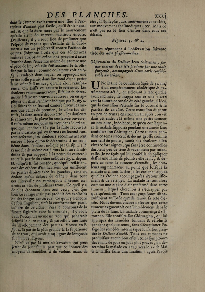 4an$ le cautere avoit trouvé une iflue à l’ex- tête, à l’épilepfie , aux mouvemens convulfîfs, teneur d’autant plus facile, qu’il étoit natu- aux mouvemens fpafmodiques ? &c. rel,&que la dure-mere par le mouvement n’eft pas ici le lieu d’entrer dans Mais ce tous ces facilitoit encore, détails. Figures 3. CT 4. qu'elle tient du cerveau D’ailleurs , il y a tout lieu de préfumer que l’efpéce de vapeur qui s’exhale de la dure- mere a été un préfervatif contre l’aétion de ce pus. Joignons à cela que ces adhérences intimes aux os du crâne ont préparé à cette lymphe dans l’enceinte meme du cautere une Observation Au Dofleur Jean Saîtzman , fur Elles répondent à l’obfervation fuivantc tirée des a fl a phyjïco-medica. cfpéce de lit, où elle s’eft accumulée & offi- fiée par la fuite , comme on le peut voir en A. fg. 1. endroit dans lequel on apperçoit une petite foffe garnie dans fon fond d’une petite lame offeufe fi mince, qu’elle étoit rranfpa- rente. On Iaiffa ce cautere fe refermer Les douleurs recommencèrent, il fallut fe déter¬ miner à faire un nouveau cautere : on en ap¬ pliqua un dans l’endroit indique par B. fig. 2.. Les fuites de ce fécond cautere furent les mê¬ mes que celles du premier, le crâne fut dé- une tumeur de la tête produite par une chair fongeufe , accompagnée d’une carie confidé- rable du crâne. * U Ne Dame de condition âgée de y 4 ans,' d’un tempéramment cholérique & ex¬ trêmement aélif, en s’élevant la tête qu’elle avoit inclinée, fe frappa contre une pierre vers la future coronale du côté gauche, fi bien que la contufion s’étendit fur le coronal & le pariétal de ce côté. Cette contufion difparut truit, la dure-mere découverte r les douleurs en peu de tems ; environ un an après , on vit fe calmèrent, la playe'fut confervée ouverte ; dans cet endroit là même une petite tumeur il relia même toujours un trou dans le crâne, un peu dure, indolente, & qu’en conféquen- quoique l’endroit fût par la fuite recouvert ce la malade fupporta pendant une année fans par la cicatrice qui s’y iorma ; ce fécond cau¬ tere refermé , les douleurs recommencèrent encore fi bien qu’on fe détermina à un troi- fiéme dans l’endroit indiqué par C.fig. i.; le crâne fut de même carié vers la future lamb- doïde & par rapport à la pente du cautere confulter fon Chirurgien. Cette tumeur pen¬ dant ce tems s’accrut & devint groffe comme une œuf de poule , caufa des douleurs allez vives & fort aigues , qui fans être continuelles duroient peu de tems & revenoient par inter¬ valle. Je ne fçais qui lui confeilla d’appliquer toute la partie du crâne indiquée fig. %. depuis deflus une lame de plomb : elle le fît , & de- D. jufqu’â E. fut rongée , quoiqu’il reliât en- puis ce tems la tumeur s’étendit, les dou- core des efpéces d’offifications qui unifioient leurs augmentèrent au point que lorfque la les parties droites avec les gauches, tant en malade indinoit la tête, elles étoient fi aigues dedans qu’au dehors du crâne ; dans tout qu’elles étoient accompagnées d’étourdiffe- cet intervalle on remarquoit differens en- mens & de vertiges. La malade fentoit alors droits criblés de plufieurs trous. Ce qu’il y a comme une efpéce d’air renfermé dans cette de plus étonnant dans tout ceci, c’efl que tumeur, lequel cherchoit à s’échapper par tout ce ravage n’ait pas produit des exollofes quelqu’endroit. Tous ces fymptômes difpa- ou des fongus cancéreux. Ce qu’il y a encore roiffoient aufiî-tôt qu’elle tenoit fa tête éle¬ vée. Nous devons encore obferver que cette tumeur augmentoit confidérablement dans le plein de la lune. La malade commença à s’é¬ tonner. Elle confulta fon Chirurgien , qui lui de fort fîngulier, c’eft la conformation parti¬ culière de ce crâne. Vers le concours de la future fagittale avec la coronale, il y avoit dans l’occipital même un trou qui pénétroit jufqu’â la dure mere ,, & paroiffoit une fuite appliqua des remèdes fondans & réfolutifs du dévelopement des parties. Voyez en F. pendant quelque tems, fans difeontinuer l’u- fig. 1. la partie la plus grande & la fupérieure iâgedes remèdes internes que luifaifoit pren¬ de ce trou , qui avoit cinq lignes de longueur fur huit de largeur. N’eft-ce pas là une obfervation qui peut jetter du jour fur la pratique & donner des moyens de remédier â de violens maux de dre le Dofleur Scheid. Tous ces remèdes ne produifant aucun bon effet, & les fymptômes. devenant de jour en jour plus graves , on dé¬ termina la malade en 1717 vers le 2 y de Mai à fe lailfer faire une incifîon ; après, l’avoir