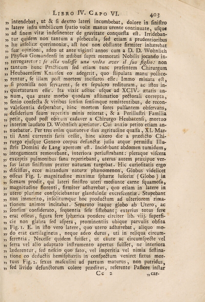 „ intendebat, ut & fi dextro lateri incumbebat, dolore in finiftro 35 latere infra umbilicum fpatio volse manus urente continuate, ufque 3, ad finem vitas indefinenter de gravitate eonquefta eft» Irrideban» 33 tur quidem non tantum a plebecula, fed etiam a prudentioribus 33 hx infolks querimonia , aft hoc non obliarne' firmifer inhserebàt 33 fuse opinioni, adeo ut ante viginti annos cum a D. D. Wohnlich 33 Phyfico Gemundenfi in sedibus fupra memorati Nobilis jocando in- 33 terrogaretur : fe ella volejje una *volta aver tl fuo figlio : non 33 tantum' hunc Praélicum fed etiam lune prsefentem Chirurgum 33 Heubaceniem Knauien eo adegerit, quo flipuiata manu pollice- 33 rentur, fe iilam poli mortene incifuros elle: Immo minata eli, 33. fi promiffa non fervarent, fe ex fepulcro redituram, ac iftos in- 33 quietaturam elle • Ita vixìt adhuc ufque ad XCIV« setatis an- 33 num, qua state morbo quodam afihmatico perorali correpta, 33 fenio confetta 8c vi ribus fènfim feniìmque remittentibus, de recon- 33 valefcentia defperabat, hinc mortem fores puifantem obièrvans, 33 defiderium fuum repetitis minis reiterar 5 & a Periiluftri Familia 3, petit, quod poli obiturn cada ver a Chirurgo Heubacenfi, mortilo 33 interim laudato D. Wohnlich aperiatur. Cui anxio petito etiam an» 33 nuebatur. Per tres enim quatuorve dks sgritudine quaffa, XL Mar- 33 tii Anni currentis fatis ceffit, hinc altero die a prsdidlo Chi- 3, rurgo ejufque Genero corpus defunéìs: jufiu atque permiffu Illu» 33 ftris Domini de Lang apertimi eli. Incidebantabdomen tumìdum^ ,3 integumenta removebant, interiora periuftrabant: pleraque vjfcera 33- exceptis pulmonibus fana^ reperiebant, uterus aurem precipue ver- 33 fus latus finiffrum prster naturarti turgebat. Hic curiofitatis ergo 3, difeiffus, ecce mirandum naturs phsnómenon, Globus videlicet 33 offeus Fig. L magnitudine maxims fphsras luforis (Globo) in 33 feenam prodit, qui lateri finiftro uteri mediante carne fquamofa, 33 magnitudine fiorenti, firmiter adhserebat, quo etiam in latere in 33 utero plurime confpiciebantur glandulofs exerefeentìs. Stupebant 33 non immerito, infolitumque hoc produdlum ad ulteriorem rima- 33 tionem animos incitabat. Separato itaque globo ab Utero, ac „ feorfim confiderato, feqaentia fefe fiftebant; exterius totus fere 3, erat ofteus, figura fere fphserica pendere circiter lib. viij. fuperfì- 3, eie non glabra fed afpera, prominentiis ubique parvuìis obfita 33 Fig. 1. E. in ifto vero latere, quo utero adhserebat, aliquo mo- do erat cartiSagineus, neque adeo durus , uti in reliqua circum» ,3 ferentia. Neceffe quidem fuiflet, ut caute ac circumfpedle vel 33 ferra vel alio adaptato inftrumento apertus fuiffet, ne interiora 33 Isederentur, fed nefeio quo fato, vel imperitia vel nimia fettina- „ tiene eo deduòlis hemifphsriis in corifpeélum veniret faetus mor- ,3 tuus Fig. 2. fexus mafculini ad partum maturus, non putridus^ 3, fed livido defundìorum colore prseditus, referente Pallore inftar C c 2 „ car»