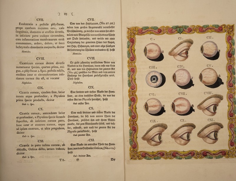 CVII. Exulceratio a pullulis phly&aens, propc canthum majorem orta, vafis fanguineis, diametro et craditie diveriis, in iaferiore parte undique circumdata, cum inflammatione membranarum oculi communium, ardore, dolore, et fucci lachrymalis abundantia conjunda, dicitur Homiclos. ' a * ► ► *** \ CYIII. Cicatricum corner decern diverfx numerantur fpecies, quarum prima, exi- gua, a phlydxnae 2. Spec, puftulis relida, medium inter et circumferentiam infe- riorem corner fita eft, et vocatur Nephelion. CIX. Cicatrix cornese, ejusdem fltus, latior tamen atque profundior, a Phyofeos prima fpecie produda, dicitur Oule I. Spec. cx. Cicatrix cornex, antecedente latior et profimdior, a Phyofeos fpecie fecunda fuperites, ab iaferiore corneae parte, hanc inter et centrum corneae, usque ad ipfum centrum, et ultra progediens, dicitur Oule 2. Spec. CXI. Cicatrix in parte infima cornex, ab abfeeflu, Ocfima dido, ortum trahens, dicitur Oule 3. Spec* CVII. ©ne t>on ben ipi^blattcrn, (No. 97- 98.) neben t>em qvogen SHugenmmfel t»erurfatf;te Sct’fc^tudnmg, &u roelcbec t>on unten fjee aUcr- dele SMutgefdpe m\ wfd)iet>ener58ette unt> St<fe l)mlaufen, unt> weld)e mtt etner ©itjuntmn^ Der gemetnen Svante t>es £lucie$, mtt ©cfyner^en, unt> etner all&u (jauftejett Sibfonberung bey X^ranen r>erlnmt>en i\t, &eipt Homiclos« CVIIL (£$ gtebt jeljnerlep t>erfcf)tebene 2lrfen fcon sftat&en tn bet* Jpornljaut, beten erffe nur flein t)f, uut> son ben jpi|5lattern t>er &woten 2lrt (No. 98.) &tntfd)en t>er Settle unt) fcem untern Untfange bet* ^orn^ant ^urucP^elaffen wirt>t Siefe f)eigt Nepheliort. cix. ©tie breitere unb ttefere Sftarbe bet £orm bant, an ebett betfeI6en ©telle, bte bon bet erjlett 2lrt bet Phyofis (jerruljrt, fjeifit Oule Cl'ftCt 2lt't. CX. ©ne noefj bceitere ttnb ttefere 9?arbe bet £>ornfj«ut, bte ftd) bom untern Sfietle bet jpovuf)aut, jtbifd)en tfmt ttnb intern SDJtttel* puitfte, bib jumfKittelpunfte felbjl, unbbrtu bet, erfhrecFt, utib nacf) bet jrooten 2lrt bee Phyofis jurucfbletbt, ^etjjt Oule jwotet Site. - CXI. Sine 9?arbe tm unter(Ien Sljetle bet #otrts fjaut, bon bem ©cfdmwre Oefima, (No. 1 o 2.) fieijit Ouh bttttet 2lrt. . © £>tf TA-