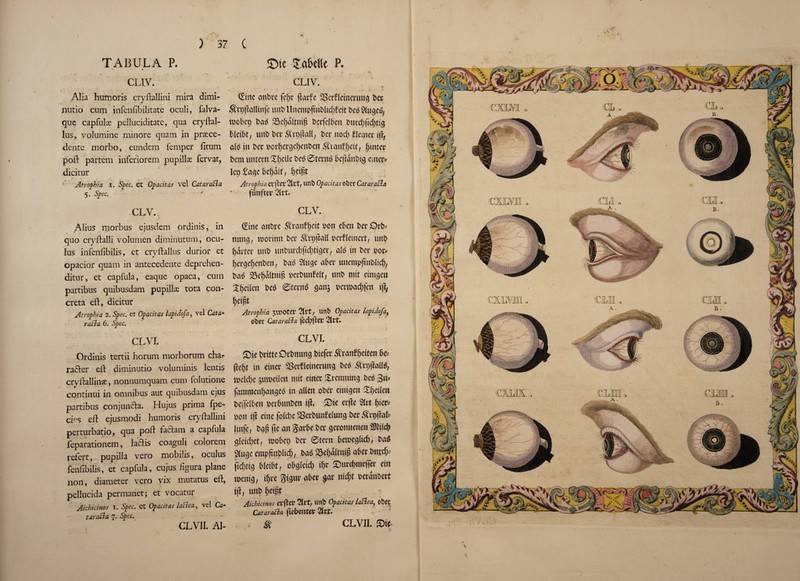 ) TABULA P. CUV. Alia humoris cryftallini mira dimi- mitio cum infenfibilitate oculi, falva- que capfuls; pelluciditate, qua cryftal- lus, volumine miiiore quam in prsece- dentc morbo, eundem femper litum poft partem inferiorem pupillae fervat, dicitur Atrophia i. Spec, et Opacitas vel CataraBa 5. Spec. '' ' 37 C £Me Xabelle P. ** >> _ , . • CLIV. (Etnc cmPre fepr ftarfe §Serf(emerung Pet ^rpftadinfe tint) ltnempjtnPlid)fett PcP $lugeP; toobep PaP Se^dltitip PerfelPcit Purd)fu|>d& PleiPt, nut) Per Sn#all, Per nod) Reiner i|T, alP in Per por^crgef)enPen Srcmfjjeit, Winter Pent untern Xl)eile PeP 0ternP PefrdnPtg enter? let) £a$e fcefjdlt f Ijeipt Atrophia ctfter 21ft, unP Opacitas obet CataraBa funftev 2lvt. CLV. CLV. Alius morbus ejusdem ordinis, in quo cryftalli volumen diminutum, ocu- lus infenfibilis, et cryftallus durior et opacior quam in antecedente deprehen- ditur, et capfula, eaque opaca, cum partibus quibusdam pupillae tota con- creta eft, dicitur Atrophia 2. Spec, et Opacitas lapidofa, vel Cat a* raBa 6. Spec. CL VI. Cine rntPte ^rattfljeit oott e6en Per OrP= nuns, tnortnn Per Srpftall oerfleinert, unP garter unP unPurcbfidjtiser, alP in Per oor* IjerseljenPen, PaP 2luse aPer unentpftnPlicf), Pae Saepdltntp oerPunfelt, unP mit eimsen Xpeilett PeP 0ternP gan$ oemacf)|en iji, peiftt Atrophia $re>Otcr %Vt, unP opacitas lapidofa, oper CataraBa fed)fter 2tvu •-.... • ■ ] : i CL VI. Ordinis tertii horum morborum char rafter eft diminutio voluminis lends cryftallinae, nonnumquam cum folutione continui in omnibus aut quibusdam ejus partibus conjunfta. Hu jus prima fpe- ers eft ejusmodi humoris cryftallini perturbatio, qua poft iaftam a capfula feparationem, laftis coaguli colorem refert, pupilla vero mobilis, oculus fenfibilis, et capfula, cujus figura plane non, diameter vero vix mutatus eft, pellucida permanet; et vocatur Aichicinos 1. Spec, et Opacitas laBea, vel Ca- taraBa 7* Spec, CLVII. Al- Sie britteOrbnung bicfer .St'aitfbeitcrt bc-- gcfjt in etnev SOctfleinecung beb &rt>|hlB, icdd)e junxueit mit etner Srennung bes 3n* faminengattgeb in alien ober eintgeu Sgeilen beifclbett berbunben i(l, £>te erjle Slit f)(cr= mi if! cine folcl)c SSerbunfelung bet .<flit)ftab linfe, bag fie an §arbc ber getonnenen SKtlcf) glcid;et, reobet) ber 0tertt bercegltd), baS Singe empftnbltd), bas 23c()dltmg abet buedj-- ftegtig bleibt, obgleid) if)r ©urogmeffer ein luemg, tfjre gigur aber gar md;t berdnbert ijl, nnb f)eipt Aichicinos after Sift/ Utl& Opacitas laBea, cbet CataraBa ficbcilttl 2llt. & CLVII. Sie •i