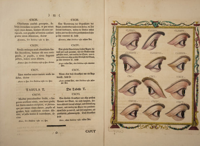 / CXCIII. • ' . * ’ * ‘ Objeftorum confufa perceptio, fe- brem immediate excipiens, et per totam segri vitam durans, lentium ufu non cor¬ rigenda, cum pup ilia ad luminis confueti gradus nimia dilatatione, dicitur Afcotomia, five Debilitas vifus 8. Spec. CXCIV. Similis utriusque oculi obnubilatio fen- fim fuccrefcens, lentium ufu non corri¬ genda , et pupilla, a nimia languinis ■ jadhira, itidem nimis dilatata, Arates l.Spec. fiveDebilitasvifus9.Sfec. dicitur. ' , *, * • * - ■ ' - ' ■ ‘ ; cxcv. Idem morbus unico tantum oculo in- feftus, dicitur Arates 2. Spec, five Debilitas vifus I o. Spec, TABULA T. cxcvi. M ' Morbus prstcedentibus fimilis, a fan- guinis amiflione nimia, non lento gradu, fed ftatim eandem excipiens, et plerum- que per totam vitam durans, pupilla ad gradum lucis confuetum nimium dila¬ tata, et jufto lentius fe contrahente, di¬ citur llhas, five Debilitas vifus II, Spec. CXCIII. I 1 . ; Sine SJertbimmcj ber ©egcnjtanbe be$ ^lugeg, unmittelbor nad) eiitem Stcbcr, bte %c\t £eben£ fortbauert, wobep bic Sntten nirf)tS f)dfen, unb bet* ©tent bep gcmbfjnlidjem giefyte ju feljr erweitert ijt, Ijeifn: Afcotomia, ober Debilitas vifus fleeter 2(rC* . . CXCIV. Sine gteidje Itmnebelunc} bepber$u$en, bte md) unb md) ^untmmt, mit ben 23rtllenmrfjt ^ebejfertn>irbt unb roobep bet*©tern, boneU nem erltttenen att^u grojtenSSerlujle be^SMun?, ju feljr ermettert tjl, f)etpt Arates erfter^lrt, ober Debilitas vifus neuntcr Zvu v CXCV. 38enn eben biefc ^eanfljeit nur ein %W betrtfft, Ijeijtffte Arates 3tt>Oter2(t*, ober Debilitas vifus se^n- tct Zvu £ne J.abellc T. cxcvi. ©ne o5n(icf)c .frnnft)ett eon allju grogem 5ScrIu|ic bed iSluts, Die ntdtf langfam, fon= tern alfobalb bavauf erfolgct, unbMendfaitg bauert, unb toobcp ber ©tern bet) getebgnlb cl)era£icf)tc 511 toeit ifl, unb fid) langfamer, aid getofetjnlid), jufanunenjictjt. ®tcfcStatiff)cit l)Ci|5t Rheis, obCV Debilitas vifus CilftCt 2llt. CAPUT '