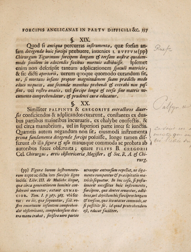 §. XIX. Quod fi antiqua percurras inflrumenta, quae forfan an- fam detegenda huic forcipi praebuere, inuenies i. rvffvm(pp) Chirurgum Tigurinum forcipem longam (f terfam mfir<s quodam¬ modo fimilem in educendis fatibus mortuis adhibuijje. lpfemet enim non defcripfit tantum adplicationem fpeculi matricis, & fic didi opertorii, uerum quoque quomodo curandum fit, ut, fi mortuus infans propter magnitudinem fuam pradiflo modo educi nequeat, aut fecunde manibus prehendi extrahi non pofi fint, uei rofiro anatis, uel forcipe longa (S terfa fine matris no¬ cumento comprehendatur, prudenti cura educatur. §. XX. Similiter palfinvs & gregorivs extra&ores diuer- fos conficiendos & adplicandoscurarunt, conflantes ex dua¬ bus partibus maioribus incuruatis, ex chalybe confedis, & uel circa manubrium, uel in fuperiori parte inter fe iundis. Quamuis autem negandum non fit, eiusmodi inflrumenta / prima fundamenta detegende forcipi poluifle, longe tamen dif- > ferunt ab illa figura ufu minusque commoda ac probata ab k autoribus fuere obferuata; quare fili vs B. gregor ii Cei Chirurgus, artis obfietricarie Magifler, (f Soc. R. A. (j Chi- rurg. (pp) Ftgura' horum inflrumenta- rum seque ac diftse iam forcipis ligno incifse. Libr. 11L de Muliebr. iisquey qiiiS circa generationem hominis con¬ fide rari merentur, extant gynae¬ cio R. Tom, I, p jd?' jdg, vbi fer¬ tur : ex iis, qua feqauntur, fcil. ro¬ firo emortuum infantem comprehen¬ dat ob(i e tricans, comprehenfum dex¬ tra manu trahat, finiflra uero partes utrasque antrorfum repellat, ne liga¬ menta rumpantur & praecipitatio ma¬ tricisfequatur. In hoc cafu, fi poftu- lauerit necejfltas huic inflrumenta, forcipem, qua dentes eruuntur, adhi¬ beas,uel depitiam hic forcipem longam & terfam, qua ita utatur commode, ut fi pojfibile jit, id quod protrahendum efl, educat faciliter*