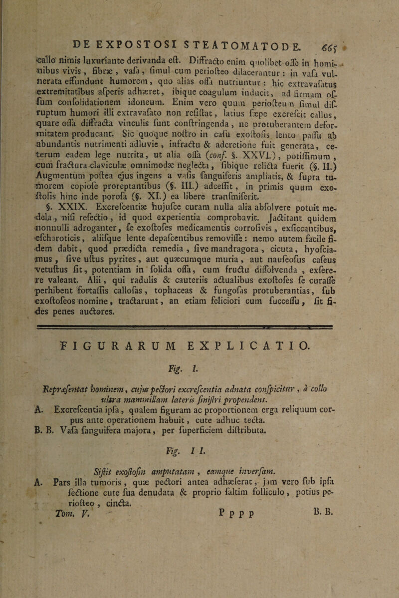 callo nimis luxuriante derivanda eft. Diffrado enim quolibet offe in homi¬ nibus vivis, fibrae , vafa, fimul cum periofteo dilacerantur: in vafa vul¬ nerata effundunt humorem, quo alias offa nutriuntur: hic extravafatus extremitatibus afperis adhaeret, ibique coagulum inducit, ad firmam of- fum confoiidationem idoneum. Enim vero quum periofteu n fimul dif- ruptum humori illi extravafato non refiftat, latius fiepe excrefcit callus, quare offa diffrada vinculis funt conftringenda , ne protuberantem defor¬ mitatem producant. Sic quoque lioftro in cafu exoftofis lento paifii ab abundantis nutrimenti adluvie , infradu & adcretione fuit generata, ce¬ terum eadem lege nutrita, ut alia offa (conf. §. XXVI.) , potiftimum , cum fradura claviculae omnimodae negleda, fibique relida fuerit (§. II.) Augmentum poftea ejus ingens a vafis fanguiferis ampliatis, & fupra tu¬ morem copiofe proreptantibus (§. III.) adceflit, in primis quum exo» ffofis hinc inde porofa (§. XI.) ea libere tranfmiferit. §. XXIX. Excrefcentise hujufce curam nulla alia abfolvere potuit me¬ dela , nifi refedio , id quod experientia comprobavit. Jaditant quidem nonnulli adroganter, £e exoftofes medicamentis corrofivis , exficcantibus, efchuroticis , aliifque lente depafcentibus removiffe : nemo autem facile fi¬ dem dabit, quod prxdida remedia, five mandragora, cicuta, hyofcia- mus , five uftus pyrites, aut quaecumque muria, aut naufeofus cafeus vetuftus fit, potentiam in folida offa, cum frudu diffolvenda , exfere- re valeant. Alii, qui radulis & cauteriis adualibus exoftofes fe curafle perhibent fortallis callofas, tophaceas & fungofas protuberantias, fub exoftofeos nomine, tradarunt, an etiam feliciori cum fucceffu, fit fi¬ des penes audores. FIGURARUM EXPLICATIO. F&. l- 'Reprafentat hominem, cujus pe&ori excrefcentia adnata confpicitnr , a collo ultra mammillam lateris finijlri propendens. A- Excrefcentia ipfa, qualem figuram ac proportionem erga reliquum cor¬ pus ante operationem habuit, cute adhuc teda. B. B. Vafa fanguifera majora, per fuperficiem diftributa. Fig. I /. Sijlit exojlofin amputatam , eamque inverfam. A. Pars illa tumoris, qux pedori antea adhxferat, jim vero fub ipfa fedione cute fua denudata & proprio faltim folliculo , potius pe¬ riofteo , cinda. Tom. V. P p p p B- B.