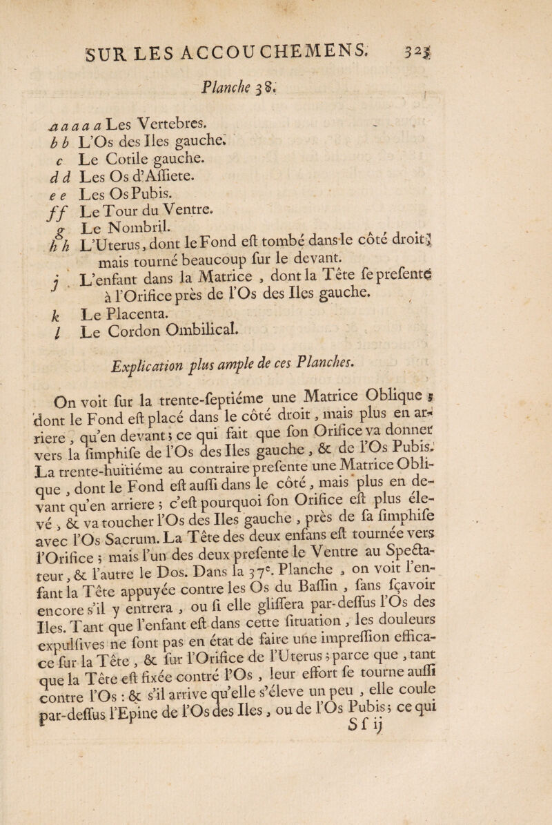 Planche 3 8. aaaa a Les Vertebres. b b L’Os des Iles gauche: c Le Cotile gauche. d d Les Os d’Affiete. ee Les Os Pubis. ff Le Tour du Ventre. a Le Nombril. A , . h h L’Uterus, dont le Fond eft tombé dans le cote droit? mais tourné beaucoup fur le devant. j L’enfant dans la Matrice , dont la T été fe prefenté J à l’Orifice près de l’Os des Iles gauche. k Le Placenta. / Le Cordon Ombilical. Explication plus ample de ces Planches. On voit fur la trente-feptiéme une Matrice Oblique s 'dont le Fond eft placé dans le côté droit, mais plus en ar* riere , qu’en devant ; ce qui fait que fon Orifice va donner vers la fimphife de l’Os des Iles gauche , & de 1 Os Pubis. La trente-huitième au contraire prefente une Matrice Obli¬ que , dont le Fond eft auiïi dans le côté, mais plus en de¬ vant qu’en arriéré 5 c’eft pourquoi fon Orifice en plus éle¬ vé > & va toucher l’Os des Iles gauche , près de fa fimphife avec l’Os Sacrum. La Tête des deux enfans eft tournée vers l’Orifice ; mais l’un des deux prefente le Ventre au Specta¬ teur l’autre le Dos. Dans la 37e- flanche > on voit 1 en¬ fant la Tête appuyée contre les Os du Badin, fans fçavoir encore s’il y entrera , ou 11 elle gliffera par-deffus 1 Os des Iles. Tant que l’enfant eft dans cette fituation , les douleurs exDullives ne font pas en état de faire une impreffion effica¬ ce la Tête , & fur l’Orifice de f Uterus ; parce que , tant que la Tête eft fixée contré l’Os , leur effort fe tourne auffi contre l’Os : & s’il arrive quelle s’élève un peu , elle coule par-deffus l’Epine de l’Os des Iles, ou de 1 Os Pubis ; ce qui