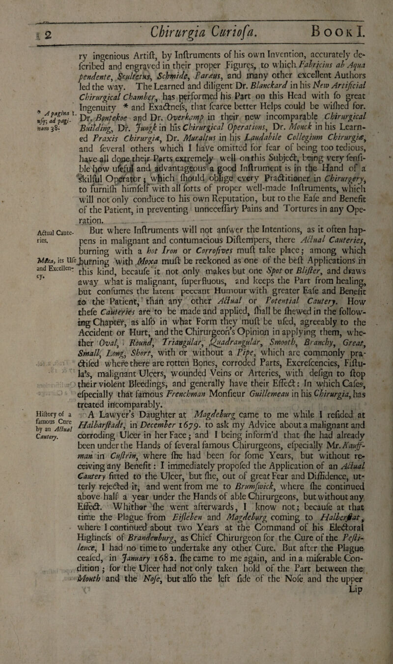 cy, ry ingenious Artift, by Inftruments of his own Invention, accurately de- fcribed and engraved in their proper Figures, to which Fabricius ab Aqua pendente, Scultetus, Schmide, Farms, and many other excellent Authors led the way. The Learned and diligent Dr. Blanchard in his Flew Artificial Chirurgical Chamber, has performed his Part on this Head with fo great Ingenuity * and Exadnefs, that fcarce better Helps could be wlfhed for. Dr. Bontekoe and Dr. Overkamp in their new incomparable Chirurgical Jm 38. * Building, Dr. Jungk in his Chirurgical Operations, Dr. Monck in his Learn¬ ed Praxis Chirurgie, Dr. Muraltus in his Laudabile Collegium Chirurgie, and feveral others which I have omitted for fear of being too tedious, have all done, their Parts extremely well on this Subjed, being very fenfi- ble how ufeful and advantageous a good Inftrument is in the Hand of a Skilful Operator} which fhould oblige every Praditioner in Chirurgery, to furniffi himfelf with all forts of proper well-made Inftruments, which will not only conduce to his own Reputation, but to the Eafe and Benefit of the Patient, in preventing unneceflary Pains and Tortures in any Ope¬ ration. _ . _ - • - Actual caute- But where Inftruments will not anfwer the Intentions, as it often hap- ries. pens in malignant and contumacious Diftempers, there Attual Cauteries, burning with a hot Iron or Corrofives muft take place; among which Ma, its Ufe Jburning with Moxa muft be reckoned as one of the beft Applications in and Exceiien- tj^s becaufe it not only makes but one Spot or Blifier, and draws away what is malignant, fuperfluous, and keeps the Part from healing, but confumes the latent peccant Humour with greater Eafe and Benefit to the Patient, than any other Aftual or Potential Cautery. How thefe Cauteries are to be made and applied, ftiall be fhewed in the follow- icjgChaptéY, as alfo in what Form they muft be ufed, agreeably to the Accident or Hurt, and the Chirurgeor/s Opinion in applying them, whe¬ ther Oval, : Round, triangular, Quadrangular, Smooth, Branchy, Great, Small, Long, Short, with or without a Pipe, which are commonly pra* difed where there are rotten Bones, corroded Parts, Excrefcencies, Fiftu- la’s, malignant Ulcers, wounded Veins or Arteries, with defign to ftop their violent Bleedings, and generally have their EfFed: In W'hich Cafes, efpecially that famous Frenchman Monfieur Guillemeau in his Chirurgia, has treated incomparably. A Lawyer’s Daughter at Magdeburg came to me while I refided at Halbarjladt, in December 1679. to ask my Advice about a malignant and corroding Ulcer in her Face; and I being inform'd that fhe had already been under the Hands of feveral famous Chirurgeons, efpecially Mr. Kauff¬ man in Cuftrin, where fhe had been for fome Years, but without re¬ ceiving any Benefit: I immediately propofed the Application of an Atlual Cautery fitted to the Ulcer, but fhe, out of great Fear and Diffidence, ut¬ terly rejeded it, and went from me to Brumfwick, where fhe continued above half a year under the Hands of able Chirurgeons, but without any Efïèd. Whither fhe w’ent afterwards, I know not; becaufe at that time the Plague from Eijleben and Magdeburg coming to Halbcrjèat, where I continued about twro Years at the Command of his Eledoral Highnefs of Brandenburg, as Chief Chirurgeon for the Cure of the Fefti- lence, I had no time to undertake any other Cure. But after the Plague ceafed, in January 1682. fhe came to me again, and in a miferable Con¬ dition ; for the Ulcer had not only taken hold of the Part between the Mouth and the Nofe, but alfo the left fide of the Nofe. and the upper V Lip Hiftory of a famous Cure by an Aftual Cautery.