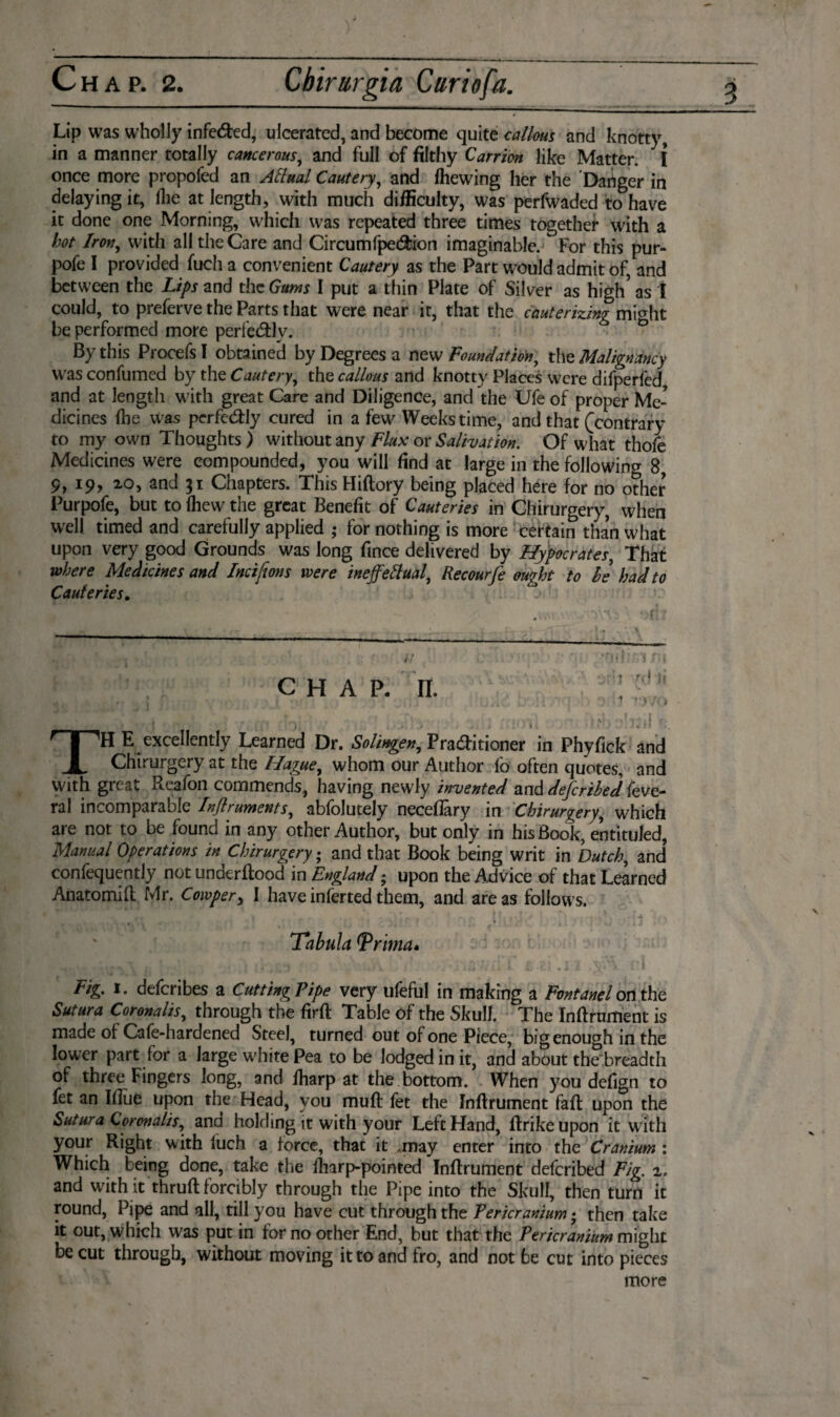 Lip was wholly infeéted, ulcerated, and become quite callous and knotty, in a manner totally cancerous, and full of filthy Carrion like Matter. I once more propofed an Aftual Cautery, and (hewing her the Danger in delaying it, (lie at length, with much difficulty, was perfWaded to have it done one Morning, which was repeated three times together with a hot Iron, with all the Care and Circumfpe&ion imaginable. For this pur- pofe I provided fuch a convenient Cautery as the Part would admit of, and between the Lips and the Gum I put a thin Plate of Silver as high’ as I could, to preferve the Parts that were near it, that the cauterizing mi^ht be performed more perfectly. By this Procefs I obtained by Degrees a new Foundation, the Malignancy was confumed by the Cautery, the callous and knotty Places were difperfed and at length with great Care and Diligence, and the Ufe of proper Me¬ dicines (he was perfctftly cured in a few Weeks time, and that (contrary to my own Thoughts) without any Flux or Salivation. Of what thofe Medicines were compounded, you will find at large in the following 8, 9, 19, 20, and 31 Chapters. This Hiftory being placed here for no other Purpofe, but to (hew the great Benefit of Cauteries in Chirurgery, when well timed and carefully applied ; for nothing is more certain than what upon very good Grounds was long fince delivered by Hypocrates, That where Medicines and Incifions were ineffectual, Recourfe ought to he had to Cauteries. CHAP. II. ' ■ ' «5 < j f 4 \i : , . ƒ .'i / '7 f‘)VU A 1 i 1 f I f ?** t ‘ , • > . > * J i . I ' ' I » ' 1 '* Jt Jjli i| TH E excellently Learned Dr. Solingen, Praditioner in Phyfick and Chirurgery at the Hague, whom our Author fo often quotes, and with great Reafon commends, having newly invented and deferihed (eve- ral incomparable Inflruments, abfolutely neceflary in Chirurgery, which are not to be found in any other Author, but only in his Book, entituled. Manual Operations in Chirurgery; and that Book being writ in Dutch, and confequently not underftood in England• upon the Advice of that Learned Anatomift Mr. Cowper> I have inferted them, and are as follows. - • « l 4 J ' i t 1 ’ • t A N/ I J Tabula (Prima- I ^ 'v Ii A Jo • C.i • J JL • V* A. •« Fig. i. deferibes a Cutting Pipe very ufeful in making a Fontanel on the Sutura Coronalis, through the firft Table of the Skull. The Inftrument is made of Cafe-hardened Steel, turned out of one Piece, big enough in the lower part for a large white Pea to be lodged in it, and about the breadth of three Fingers long, and (harp at the bottom. When you defign to fet an Blue upon the Head, you mud fet the Inftrument faft upon the Sutura Coronalis, and holding it with your Left Hand, ftrike upon it with your Right with luch a force, that it .may enter into the Cranium : Which being done, take the fharp-pointed Inftrument deferibed Fig. z. and with it thruft forcibly through the Pipe into the Skull, then turn it round, Pipe and all, till you have cut through the Pericranium; then take it out, which was put in for no other End, but that the Pericranium might be cut through, without moving it to and fro, and not be cut into pieces more