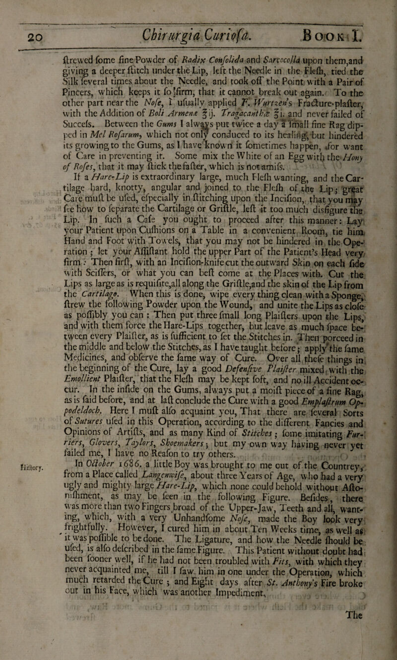 ftrcwed fome fine Powder of Radix Confolida and Sarcocolla upon them,and giving a deeper flitch under thé Lip, left the Needle in the Flefh, tied the Silk feveral times about the Needle, and took off' the Point with a Pair of Pincers, which keeps it fojfirm, that it cannot break out again. To the other part near the Nofe^ Ï ufually applied V\,Wurizens Fratfture-plafter, with the Addition of Bolt Armens, §ij. Tragacarithfi. and never failed of Succefs. Between the Gums I always put twice a day a Email fine Rag dip¬ ped in Mel Rofarum, which not only conduced to its healing, but hindered its growing to the Gums, as I have known it fometimes happen, Tor want of Care in preventing it. Some mix the White of an Egg with the Hony of Rofes, that it may flick the fafler, which is notamifs. If a HarerLip is extraordinary large, much Flefh wanting, and the Car¬ tilage hard, knotty, angular and joined to the Flefh of the Lip; great Care muff be ufed, Specially in Hitching upon the Incifion, that you may fee how to leparate the Cartilage or Griffie, left it too much disfigure the Lip. In fuch a Cafe you ought to proceed after this manner: Lay your Patient upon Cufhions on a Table in a convenient Room, tie him. Hand and Foot with Towels* that you may not be hindered in the Ope¬ ration ; let your Affiftant hold the upper Part of the Patient’s Head very firm : Then firft, with an Incifion-knifecut the outward Skin on each fide with Sciffèrs, or what you can beft come at the Places with. Cut the Lips as large as is requifite,all along the Griffie,and the skin of the Lip from the Cartilage. When this is done, wipe every thing clean with a Sponge, ftrew the following Powder upon the Wound, and unite the Lips as clofe as poffibly you can : Then put three fmall long Plaifters upon the Lips, and with them force the Hare-Lips together, but leave as much fpace be¬ tween every Plaifier, as is fufficient to fet the Stitches in. Then porceed in the middle and below the Stitches, as I have taught before; apply the fame Medicines, and obferve the fame way of Cure. Over all thefc things in the beginning of the Cure, lay a good Defen five Plaifter mixed, with the Emollient Plaifter, that the Flefh may be kept foft, and no ill Accident oc¬ cur. In the infide on the Gums, always put a moift piece of a fine Rag, as is faid before, and at laft conclude the Cure with a good Emplaftrum Op- podeldoch. Here I muff alfo acquaint you, That there are feveral Sorts of Sutures ufed in this Operation, according to the different Fancies and Opinions of Artifts, and as many Kind of Stitches; fome imitating Fur¬ riers, Glovers, Taylors, Shoemakers j but my own way having never yet failed me, I have no Reafon to try others. In Ottober 1686. a little Boy was brought to me cut of the Countrey, from a Place called Langenwife^ about three Years of Age, who had a very ugly and mighty large Hare-Lip, which none could behold without Afto- mfhment, as may be leen in the following Figure. Befides, there Was moré than two Fingers broad 0/ the Upper-Jaw, Teeth and all, want- ing, which, with a very Unhandfome Nofe7 made the Boy lopk very frightfully. However, I cured him in about Ten Weeks time, as well as it was poffible to be done. The Ligature, and how the Needle fhould be ufed, is alio delcribed in the fame Figure. This Patient without doubt had been föoner well, if lie had not been troubled with Fits, with which they never acquainted me, till I faw him in one under the Operation, which much retarded the Cure ; and Eight days after St. Anthony's Fire broke out in his Face, which was another Impediment, The