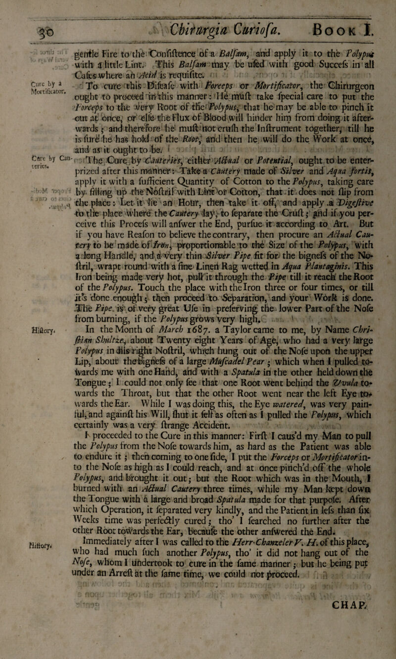 3° -j'i 'jjitb eir *<j ' b )/ Cure by a Mortifkacor. Cöre by Can teries. : fyjM TXjOiW ft Jim OJè^liiJ Hiöory. Hfftory. M Cbirurgia Curio fa. Book I, gentle Fire to thè Confidence of a Balfam, and apply it to the Polypus with a little Lint. This Balfam may be ufed with good Succefs in all Cafes where an Acid is requisite. To cure nthis Difcafe with Forceps or Mortificator, the Chirurgeon ought to proceediïithis manner: Hé mtifl take fpecial care to put the ■Forceps to the very Root of the' Polypus, that he may be able to pinch it out at once, or elfe the Flux of Blood will hinder him from doing it after¬ wards ; and therefore he mufLnot crulli theInftrument together, till he is lure he has hold of the Roof and then he will do the Work at once, and as it ought to he. 1 ; The Cure by Cauteties, either Aftual or Potential, ought to be enter- prized after this manner : Take a Cautery made of Silver and Aqua fortif apply it with a fufficient Quantity of Cotton to the Polypus, taking care by filling up the Noflril with LinCor Cotton, that it does not flip from the place*. Let it lie an Hour, then take it off* and apply .a VigeJHve to die place where the Cautery lay, to feparate the Crufl; £nd if you per¬ ceive this Procefs will anfwer the End, purfue it according to Art. But if you have Reafon to believe the contrary, then procure an Aftual Cau¬ tery to be made of //tftf5 proportionable to thé Size of the Polypus, with a long Handle, and d very thin Silver Pipe fit for the bignefs of the No- ftril, wrapt round with a fine Lined Rag wetted in Aqua Plantaginis. This Iron being made very hot, pull it through the Pipe till it reach the Root of the Polypus. Touch the place with the Iron three or four times, or till it’s done enough 5 then proceed to Separation, and your Work is done. The Pipe, is' of very great Ufe in preferving the low er Parc of the Nofe from burning, if the Polypus grows very high. ' In the Month of March 1687. a Taylor came to me, by Name Cbri- flim Sbultzeabout Twenty eight Years of Age, who had a very large Polypus in diis ri^ht Noftril, which hung out of the Nofe upon the upper Lip, about thebighds of a large Mufcadel Pear • which when I pulled to¬ wards me with one Hand, and with a Spatula in the other held down the Tongue • I could not only fee that one Root went behind the Vvula to¬ wards the Throat, but that the other Root went near the left Eye to* wards the Ear. While I was doing this, the Eye watered, was very pain¬ ful, and againfl his Will, fhut it fellas often as I pulled the Polypus, which certainly was a very ftrange Accident. F proceeded to the Cure in this manner: Firfl: I caus’d my Man to pull the Polypus from the Nofe towards him, as hard as the Patient was able to endure it ,* then coming to one fide, I put the Forceps or Mortificator in¬ to the Nofe as high as I could reach, and at önce pinch’d off the whole Polypus, and brought it out ,* but the Root which was in the Mouth, i burned with an Aftual Cautery three times, while my Man kept down the Tongue with a large and broad Spatula made for that purpole. After which Operation, it feparated very kindly, and the Patient in lefs than fix Weeks time was perfe&ly cured; tho’ I fearched no further after the other Root towards the Ear, becaufe the other anfwered the End. Immediately after I was called to the Herr Cbanzeler H. of this place, who had much fuch another Polypus, tho’ it did not hang out of the FTofe, whom I undertook to cure in the fame manner; but he being put under an Arrefl at the fame time, we could not proceed. CHAR