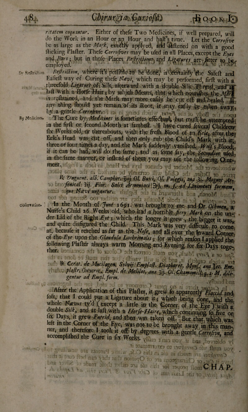 Dy ReftrièVion tthsM u-;uii.i 3y Medicines. Obfemtion. ritatem coqaantur. Either of thefe Two Medicines, if well prepared, will do the Work in an Hour or .an Hour. and half’s time. J^et the Corrofive be as large as the Marf, exactly applyed, arid Aliened pn with a good (licking Flatter. Thefe Corrofives may beufed in all Places, except the Eyes employed! ^ » th«fe . RtjiriMoH, 'pcMe-te'- bé'Vtóri^ W Safcft and Ealtdt way of Curing thefe N^z//, which may be performed, firft with a threefold Ligat^eja^ &lkva%rward with a double ^i 1 kbSEhWarix-.atïcTa|' hi\ with a Hoffe.-flair; hy which Means, that, which npyr#^i?/ip AfM is reit rained, andnthe Mark may more eafily ,be cut off ff any thing ffould yet remain, of .its itoot^ eafily freaken away.; 2» gnbd rloirlw m^vtdt ’lo YboÖ ar!) noau The Cure by /Meditines is fometitries efter^ual^ \but muft-bp. attempted') in the firft or fecond Month at fartheff ofS cured Ïewraï Children fix Weeks old, qr thereabouts, with the freih Blood of an .-Eefe after th?? Eeles Head was,:iciit off; and then .only rub t(ie Child’s. Mark with if' three or four thpes a day, and,the Mark fuddenly vanifhed.;, -Wolfs -Blood’; if it can be had, will do the fame;, and as, feme fay,.the,^epuyid/ne ufed in the fame manngiyior inflead pf them you mayqfc the following Oint- meüt.y:r;y i £ rfotTi ni bnrff tmI gyxJ oontdo yd isriioM srit lavao) jvsriw 'VJilq öfiifit sift tó bïhem ad ylnic^e- ill/: bfitD adz f3iibd io nna ** Vnguent. alb. Camphor. Baxi, Of Bukgiï, ana ii. Magnet Ay- fenical Jij. Flor. SalM Arwomaci [ Qtft: ph. 'fe ad-, fJnmenti for mam ivJ °>{quo Navïmgantur. ffrrfaiH of- ’ * ool ion < r. 4Jj1 c*1 >jJ-j 00:i 13li '?71- era v.. j ;oivi ebrfi ni *> 3 . . 3me ïö9‘- Was brought to; me and Dr. Ochme* a Nurfe s Child 26 Weeks old, who -had a horrible Jfery Mark on the un- der Lid of the Right Eye 5, which the longer it grew , the biseer it was ‘ and quite disfigured the Child. This Mark was very 'difficult to come’ at, becaufe it reached as far as the Nofe, and all oyer the Inward Corner of the Eye upon the Glmdnla Lachr\mlis ■, for which reafon I applied the following Plafter always warm Mopping and Evening lor fix Days tone- theft bonk n >,-ft V. % . .‘Tb ' - uO(fA!£ft Hi m£wi3ilB b frhnoM d- ^ de M*cilggen\ Syhyif \ Empfa/t, Diapboret. Mynf ana |iv. Em. ,£-P ^ r' Oxycroc+, Empl. de Melilot. ana 31). Ql. Chamomilhq,^ M. dili~ gentur ad Empl.form. '  J aril to 1: slum ?irii kO 3tll f03T|-T i.RV W*\ £ £j 1 ~ - - — ^ «-CT \ f 1 v $ fi,jj j jy j' j *q on ^ r _Ate the Application of this Plafler, it grew fo apparently //jc.iJ and .°ft, that I could put a Ligature about it j which being clone, and the whole Mm tyd (except a little in the Corner of the Eye ) with a double Silk, and at laft with a ffyrfi-fhrre, which contiming fo five or fix Days, it grew Putrid, and ;then was taken off.-' But that which was left in the Oirnerof the Eye, was not to be brought away in this man- er> and therefore 1 took it off by .degrees with a-gentle Corrofive and accomphlhed the Cure in fix Weeks. . p ; / V -- * oil/ fhjrri Hoy > ‘dj pi .) ?iflj Hi slu ni floum r Ip ]£ h noiniqO fo ots * j . ^ %)rt >-rU °  i .Ji311, . (it J^OICJ iO CHAP. f