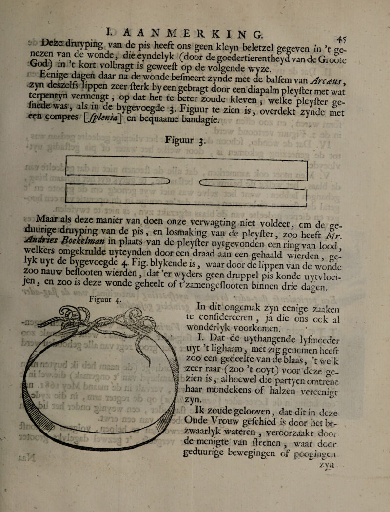 i. aanmerking. ,, Deze dnn ping van de pis heeft ons geen kleyn beletzel gegeven in ’t <4- inn’fdk 7r°nd?K dle fyndeiyk■ (door de goedertierentheyd van de GroSte c ^ • jk t Yolbragc 1S geweeft op de volgende wyze. ftenige dagen daar na de wonde befmeert zynde met de balfem van Arcaus zyn deszelfs hppen zeer fterk by een gebragt door een diapalm pleyfter met wat terpentyn vermengt, op dat het te beter zoude kleven f welke pleXr ge- ee^cnmnre^ r a/* d>rgevoeSde 3- F'g1' te zien is, overdekt zynde met een compres \_fplenia\ en bequaame bandagie. J Figuur 3. v Maar als deze manier van doen onze verwagting niet voldeet, cm de o-e- Van d? piSj en losmaking van de pleyfter, zoo heeft Air. Andries Boekelman m plaats van de pleyfter uytgevonden een ring van lood welkers omgekrulde uyteynden door een draad aan een gehaald wierden ge- lyk uyt de bygevoegde 4. Fig. blykende is, waar door de lippen van de wonde zoo nauw beflooten wierden, dat er wyders geen druppel pis konde uytvloei- J , en zoo is deze wonde geheelt of t’zamengdlooten binnen drie dagen. Figuiir 4- t j • * 1 in dit ongemak zyn eemge zaaken te confidereeren , ja die ons eek al wondérlyk voorkomen. I* Dat de uythangende ïyfmoeder uyt ’tlighaam, met zig genomen heeft zoo een gedeelte van de blaas, ’t v/elk zeer raar (zoo ’t coyt) voor deze ge¬ zien is, alhoewel die partyenomtrent haar mondekens of halzen verceninr zyn. ö Ik zoude gelooven, dat dit in deze Oude Vrouw gefchied is door hetbe- zwaarlyk wateren , veroorzaakt door de menigte van fteenen , waar door gedüurige bewegingen of poogingen zyn M ' |fl \ * ' * 1 % r