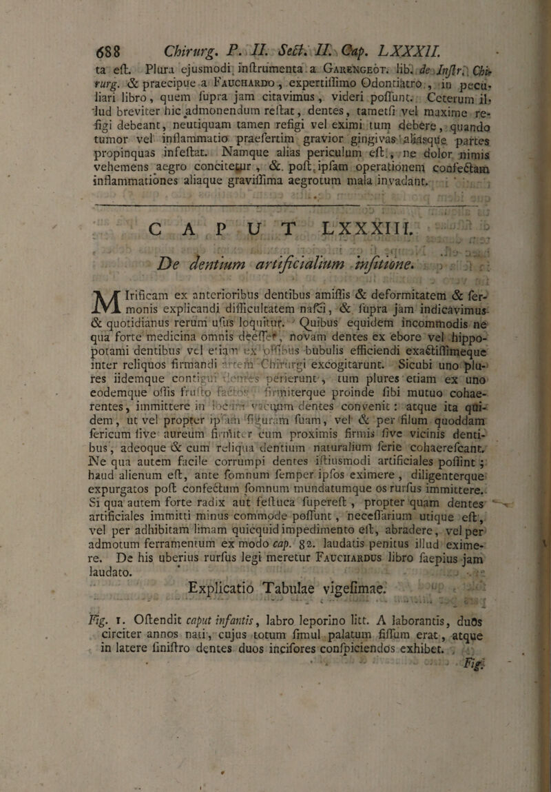ta eft. Plura ejusmodi, inftrumenta a Gauengeöt. üb. de InßrPChfr rurg. & praecipue a Fauchardo , expertiffimo Odontiiuro , in pecu¬ liari libro, quem fupra jam citavimus, videri poliunt. Ceterum il* 'lud breviter hic admonendum reflat, dentes , tametfi vel maxime re¬ figi debeant, neutiquam tamen refigi vel eximi tum debere, quando tumor vel inflammatio praefertim gravior gingivas 'aliasque. partes propinquas infeftat. Namque alias periculum efl:., ne dolor nimis vehemens aegro concitetur , &. poft.ipfam operationem confe&am inflammationes aliaque gravifiima aegrotum mala invadant. CAPUT L XX XIII. . , .• .C : Lu . . . r. p :l ;qrr , ’ ,]-j — . De dentium artificialium infitume. ; ; f: Mirificam ex anterioribus dentibus amiflis & deformitatem & Ter¬ monis explicandi difficultatem nafei, & lupra jam indicavimus- & quotidianus rerum ufus loquitur. Quibus equidem incommodis ne qua forte medicina omnis deefle£, novam dentes ex ebore vel hippo¬ potami dentibus vel e'iani ex uffibus bubulis efficiendi exaftiffimeque inter reliquos firmandi v-tem Chirurgi excogitarunt. Sicubi uno plu- res iidemque contigui perierunt', tum plures etiam ex uno eodemque offis frufto faC.-v' firmiterque proinde libi mutuo cohae¬ rentes, immittere in Ioc ito 'icuum dentes convenit: atque ita qui¬ dem, ut vel propter ip am figuram fuam, vel & per filum quoddam fericum live aureum fimlitcr cum proximis firmis fi ve vicinis denti¬ bus , adeoque & cum reliqua dentium naturalium fierie cohaerefcant. Ne qua autem facile corrumpi dentes iftinsmodi artificiales poflint ; haud alienum eft, ante fomnum femper ipfos eximere , diligenterque expurgatos poft confectum fomnum mundatumque osrurfus immittere. Si qua autem forte radix aut feftuca fupereft , propter quam dentes artificiales immitti minus commode poflunt, neceflarium utique efl; , vel per adhibitam limam quicquid impedimento elf, abradere, vel per admotum ferramentum ex modo cap. 82. laudatis penitus illud exime¬ re. De his uberius rurfus legi meretur Fauciiardus libro faepius jam laudato. Explicatio Tabulae vigefimae. ' *** ' ■* ' ^ * k'■» *1»V * i} i i ... „ O . • • Fig. r. Offendit caput infantis, labro leporino litt. A laborantis, duQs circiter annos nati', cujus totum fimul palatum filium erat, atque in latere finiflro dentes duos incifores confpiciendos exhibet.