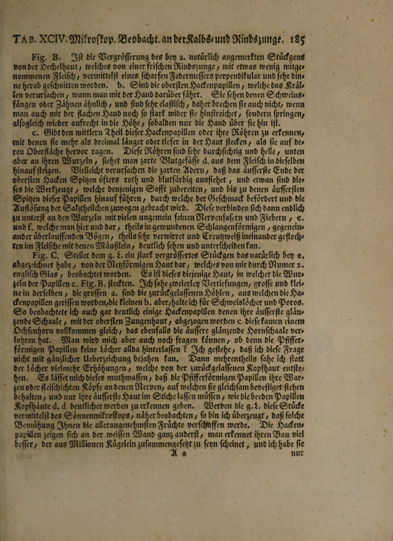 Tab. XCIV.gjJiftoffop. 33« o6«d)t. <m fectM6& uttb SKitifcÄjtmge. 18; Fig. B. bie SBergrdjferung bes 6ct; a. «afürtid; angemcrften ©tücfgen* fconbct A?ccbelhaut/ wclchestton einer frifchcn Ovittbsjunge / mit etwas wenig mitge* wommenen gleifch/ ttcrmitfelp eines fd)arfengcbcrntcffcrspctpenbifular unbfehrbin* ne herab gefchnitten worben, b. ©inb bie oberpen ipaefenpapiden / welche bas J^rdf* Jen verurfad;cn / wann man mit ber £)aub barüber fahrt. ©ie fe^en benen ©ehweins* fangen ober 3a§ncn ähnlich / unb pnbfehrelapifd;/ bal;er brechen pe auch nicht/ wenn man auch mit ber flachen £>anb nod; fo flarf wiber pe ^ln{lrclc^ef / fonbern fpringen; alfogleid; wieber aufrecht ln bie £«%/ fobalbett nur bie $anb über jte^in ip. c. ©ibfbcn mittler« ^heil biefer £acfcnpapiden ober tljre CKo^ren 5« erfennen/ mit benen ftc mehr als breimal langer ober tiefer tn bergauf fteefen/ als fic auf be# ren Obctpdch* hernor ragen. X)tefc SKohrenpnb fcfcr burchpchtig unb ^etle / unfett aber an ihren Söurjcln/ fielet man jarfc 'QSIutgefaffe d.aus bem §feifch in bicfelbcn hinaufpeigen. 2ßiedeid;t ncrurfachen bie jarfen ibern/ baf bas duflerße (Ettbe ber oberpen $a<fcn ©pifjen öfters roth unb blutfdrbig ausjtefjet , unb etwan ftnb bie< fes bie SBerfjeuge / welche benjenigen ©afft jubercitcn/ unb bis $u betten auffeeffe« ©piften biefer Rapiden hinauf führen/ burch Welche ber @>efd?ntacf beforberfuttb bie 2(upöfung ber ©al^eildten juwegen gebracht wirb. $>iefe berbittben fid? bann enblicfr ju unterp an ben 2©urjcln mit rielen ungemein feinen SRerbettfafern unb fiebern / e. unbf. welche man (der unb bar/ f^eüsingewunbenen ©chlangenfdrmigcn / gegcncin* anber überlaujfenben Q5ogen f fJeils fe^r berwirref unb Srcufjweifj ineinanber gefloc^^ ten im Slcifdje mit benen -DDtduplein / beutlid; fe^en unb uttfetfdjcibcn fan. Fig. C. ©teilet bem g. i. ein parf nergrojfertes ©tücfgen bas natürlich bei) e, abgejeidmef habe/ non ber CBe^fdrmigen lautbar/ welkes non mir burdb97umcr 2« englifch ®ias / beobachtet worben. (Es i|I biefeS biejettige £>auf/ in welcher bie 2®ttr* |eln ber Rapiden c. Fig. B. peeften. 3# fahe 6^^109 Vertiefungen/ groffe unb flri* ne in berfe!6en / biegroffen a. pnb bie jurucfgelaffenen Loipen, aus welchen bie $a* efenpapiden geriffen worben/bie flehten b. aber/halfe ich für ©chwcisldd;er unb <poros, ©0 beobachtete ich auch gar beutlid) einige ^acfenpapiilcn benen ihre dufferpe glatte 5enbe©d)aale / mit ber oberpen Sungenhauf / abgewogen worben c biefefamen einem £><hfcnhorn tjodfommen gleich/ bas ebenfalls bie dujfere gldnjenbe £iernfchaale Der*» lehren hat. Sttan wirb mich aber auch «od? fragen fdunen / ob benn bie sppffer* fdrniigen Rapiden feine lochet allba hintetlaffen ? 3d? gcffe^c / bah id) biefe $rage wicht mit gdn$lid)er Ueberjelchung bejahen fan. 3)ann mehrentheils fa^e ich Patt ber Locher nielmehr (Erhöhungen/ welche non ber $utücfgclaffencnKopfhaut ent^e* hen. (Es Idffct mich biefes muthmaffen / bap bie ^ppfferfdrmigett Rapiden t^re 2®atf Jen ober pcifdjichtcn ^dpfe an benett VerUcn/ auf welchen pc glcidbfam bebepiget pehen behalten/ unb nur ihredufferpe^antim ©tichelaffenmüffcn/ wiebiebccbcnRapide« Kopfhäute d. d beutlicher werben ju erfennen geben. 2®etbcn bie g. i. biefe ©tücfe Wermiftcipbcs ©dnnenmtftopopS/ naher beobachten/ fobin ich überjeugf / bap folche Bemühung 3hnclt aderangenehmpenSrüchte ncrfch&ffen werbe. X>ie ^aefett# papiöen jeigen pch an ber weiffen SBanb ganj anberp/ maiterfennet ihren Q3au nicl beffer / ber aus SDiidioncn ^ügelein jufammengefeßt ju fepn fcheinct, unb id; habe pe 11 a nur
