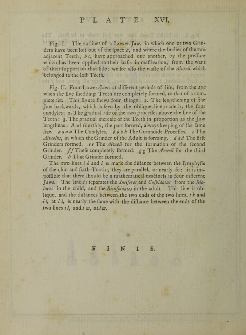 « u A ;• : yj J ?■*—- • -- ^ * **tl ’*JU > - /i • J. k v . . ./I l 'Fig. I. The outlines of a Lower-Jaw, in which one or two Grin¬ ders have been loft out of the fpace a, and where the bodies of the two adjacent Teeth, be, have approached one another, by the prefiure which has been applied to their bafts in maftication, from the want of their fupport on that fide: we fee alfo the wafte of the Alveoli which belonged to the loft Teeth. Fig. II. Four Lower-Jaws at different periods of life, from the age when the five fhedding Teeth are completely formed, to that of a com¬ plete fet. This figure fhews four things : i. The lengthening of the Jaw backwards, which is feen by the oblique- line made by the four condyles: 2. The gradual rife of the tv/o proceffes above the line of the Teeth: 3. The gradual increafe of the Teeth in proportion as the Jaw lengthens: And fourthly, the part formed, always keeping of the fame fize. aaa a The Condyles, b b bb The Coronoide Proceffes. c The Alveolus, in which the Grinder of the Adult is forming, d dd The firft Grinders formed, ee The Alveoli for the formation of the fecond Grinder. //Thefe completely formed, gg The Alveoli for the third Grinder, h That Grinder formed. The two lines i k and i m mark the diftance between the fymphyfis of the chin and fixth Tooth ; they are parallel, or nearly fo : it is im- pofllble that there fhould be a mathematical exadlnefs in four different Jaws. The line i l feparates the Incifores and Cufpidatus from the 1Mo- lares in the child, and tht Bicufpidates in the adult. This line is ob¬ lique, and the distances between the two ends of the two lines, i k and i /, at i i, is nearly the fame with the diftance between the ends of the two lines//, and i m, atlm. F I N I S.
