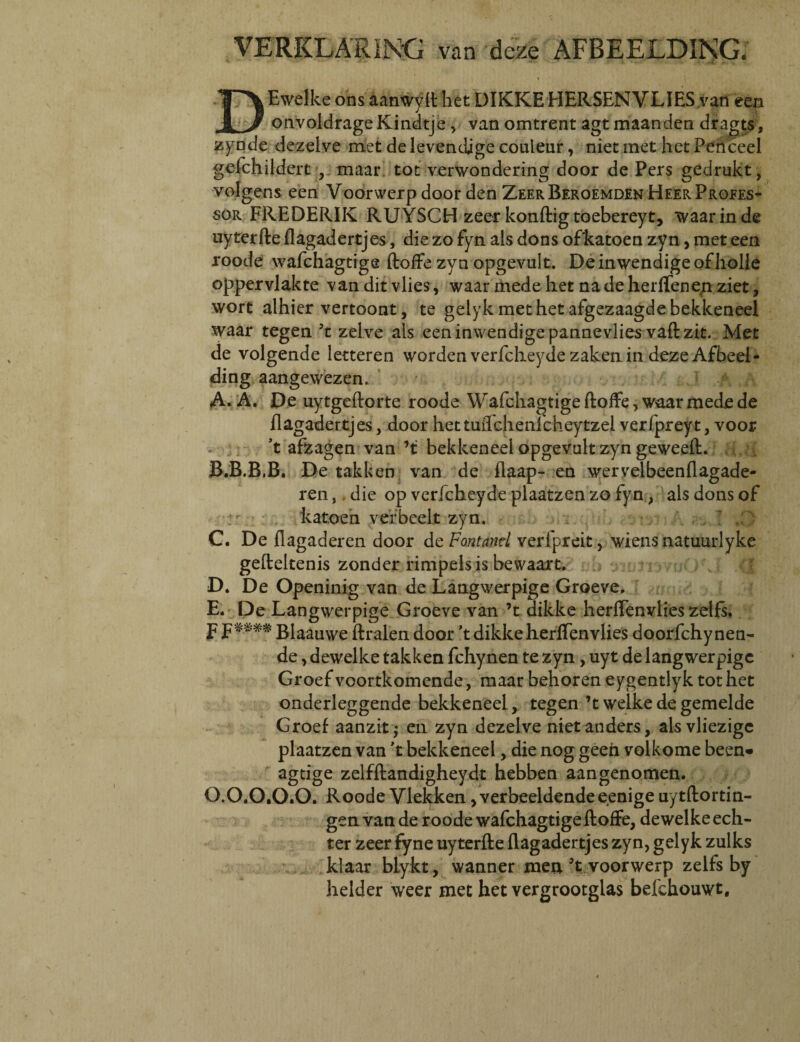 DEwelke ons aanwyft het DIKKE HERSEN VLIES van eexa onvoldrageKindtje , van omtrent agt maanden dragts, zynde dezelve met delevendjge couleur, niet met hetPenceel gefchildert maar tot verwondering door de Pers gedrukt, volgens een Voorwerp door den ZeerBeroemden Heer Profes¬ sor FREDERIK RUYSCH zeer konftig toebereyt, waarinde uyterfte flagadertjes, die zo fyn ais dons ofkatoen zyn, met een roode wafchagtige ftoffe zyn opgevult. Deinwendigeofholle oppervlakte van dit vlies, waar mede het nadeherffenep ziet, wort alhier vertoont, te gelyk met het afgezaagde bekkeneel waar tegen 5t zelve ais eeninwendige pannevlies vaftzit. Met de volgende letteren worden verfcheyde zakenin deze Afbeel- ding aangewezen. A A. A. De uytgeftorte roode Wafchagtige ftoffe, waar mede de flagadertjes, door hettuflchenlcheytzel verfpreyt, voor ’t afzagen van ’t bekkeneel opgevult zyn geweeft. B.B.B.B. De takken van de flaap- en wervelbeenflagade- ren,. die op verfcheyde plaatzen zo fyn, ais dons of katoeh ver beclt zyn. ; , C. De flagaderen door de Fontand verfpreit, wiens natuurlyke geftekenis zonder rimpelsis bewaart. D. De Openinig van de Langwerpige Groeve, E. De Langwerpige Groeve van ’t dikke herffenvlies zelfs. F F**** Blaauwe ftralen door ’t dikke herlfen vlies doorfchynen- de, dewelke takken fchynen te zyn , uyt de langwerpige Groef voortkomende, maar behoren eygentlyk tot het onderleggende bekkeneel, tegen ’t welke de gemelde Groef aanzit; en zyn dezelve nietanders, alsvliezigc plaatzen van 't bekkeneel, die nog geen volkome been» agtige zelfftandigheydt hebben aangenomen. O.O.O.O.O. Roode Vlekken,verbeeldendeeenige uytftortin- gen van de roode wafchagtige ftoffe, dewelke ech- ter zeer fyne uyterfte flagadertjes zyn, gelyk zulks klaar blykt, wanner meri ’t voorwerp zelfs by helder weer met het vergrootglas befchouwt.