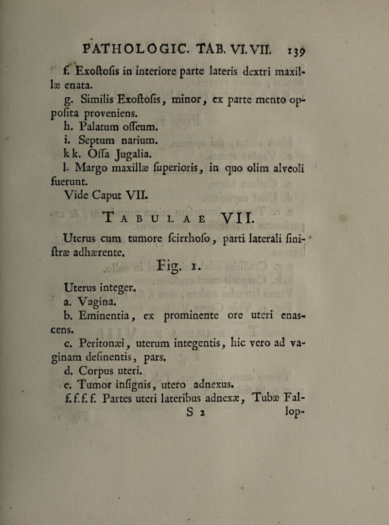 £ Exoftofis in interiore parte lateris dextri maxil¬ lae enata. » • g. Similis Exoftofis, minor, ex parte mento op^- pofita proveniens. h. Palatum offeum. i. Septum narium. kk. Offa Jugalia. 1. Margo maxillae fuperioris, in quo olim alveoli fuerunt. Vide Caput VII. Tabulae VII. Uterus cum tumore fcirrhofo, parti laterali fini- ftrae adhaerente. .. '■ • Fig: 1. Uterus integer. a. Vagina. b. Eminentia, ex prominente ore uteri enas- cens. c. Peritonei, uterum integentis, hic vero ad va¬ ginam delinentis, pars. d. Corpus uteri, e. Tumor infignis, utero adnexus. f. f.f,f. Partes uteri lateribus adnexae, Tubae Fal- S 2 lop-