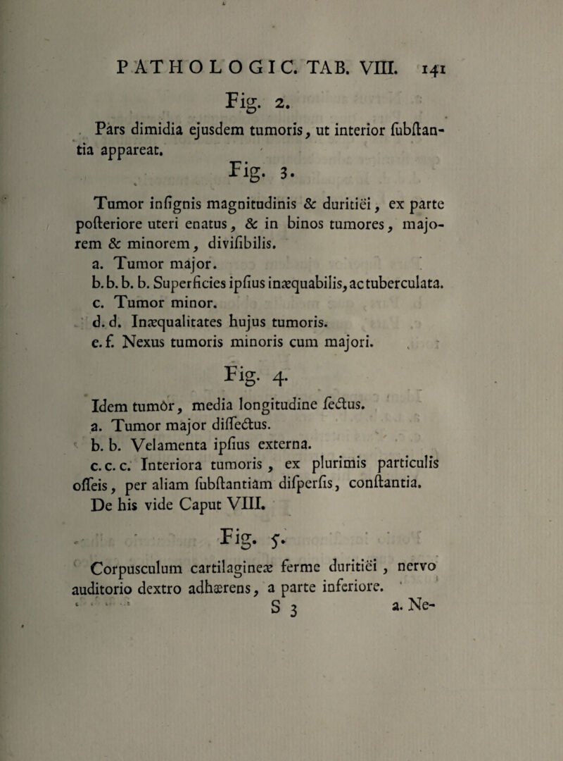 Fig. 2. Pars dimidia ejusdem tumoris, ut interior fubftan- tia appareat. Fig. 3. Tumor infignis magnitudinis & duritiei, ex parte pofteriore uteri enatus, & in binos tumores, majo¬ rem & minorem, divifibilis. a. Tumor major. b. b. b. b. Superficies ipfius inaequabilis, ac tuberculata. c. Tumor minor. d. d. Inaequalitates hujus tumoris. e. f. Nexus tumoris minoris cum majori. Fig. 4. 0 * + t * » ■ — Idem tumOr, media longitudine /edus. a. Tumor major diffedtus. r- b. b. Velamenta ipfius externa. c.c.c. Interiora tumoris, ex plurimis particulis offeis, per aliam fubftantiam difperfisj conflantia. De his vide Caput VIII. Fig. 5. Corpusculum cartilagineae ferme duritiei , nervo auditorio dextro adhaerens, a parte inferiore. S 3 a. Ne- c . . *