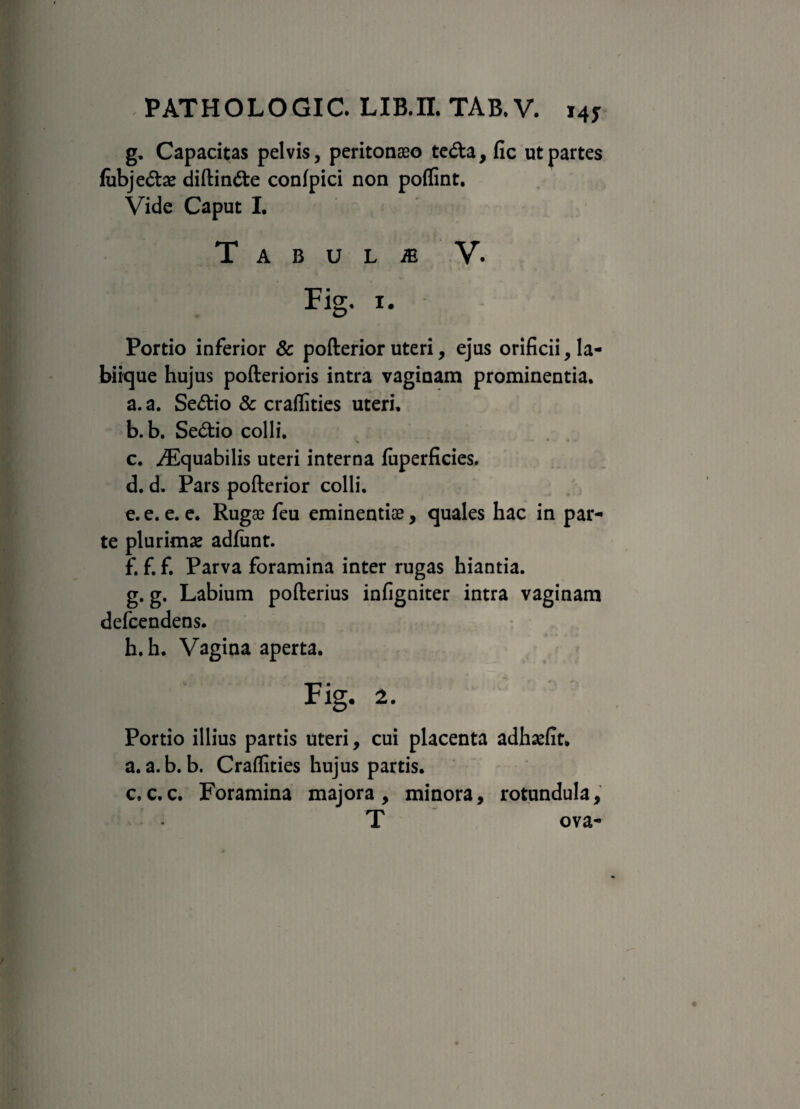 g. Capacitas pelvis, peritonaeo te<fta, fic ut partes fubje&ae diftin&e conlpici non poflint. Vide Caput I. T A B U L m V. Fig. i. Portio inferior & pofterior uteri, ejus orificii, la¬ biique hujus pofterioris intra vaginam prominentia. a. a. Se&io & craflities uteri. b. b. Se&io colli. c. ^Equabilis uteri interna fuperficies. d. d. Pars pofterior colli. e. e. e. e. Rugae feu eminentiae, quales hac in par¬ te plurimae adfimt. f. f. f. Parva foramina inter rugas hiantia. g. g. Labium pofterius infigniter intra vaginam defcendens. h. h. Vagina aperta. Fig. 2. Portio illius partis uteri, cui placenta adhaefit. a. a.b. b. Craflities hujus partis. c. c. c. Foramina majora , minora, rotundula, T ova-