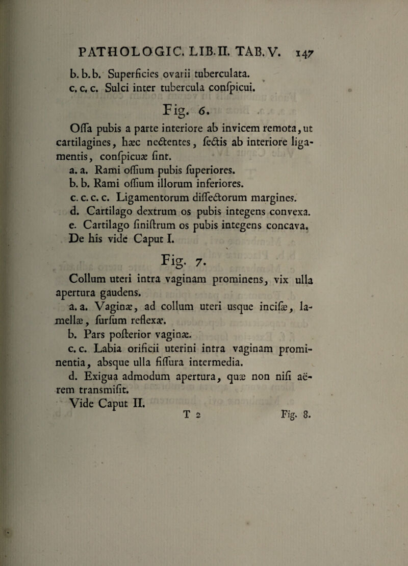 b. b.b. Superficies ovarii tuberculata. c. c, c. Sulci inter tubercula confpicui. Fig. 6. Offa pubis a parte interiore ab invicem remota,ut cartilagines, hxc ne&entes, fe&is ab interiore liga¬ mentis, confpicuae fint. a. a. Rami oflium pubis fuperiores. b. b. Rami offium illorum inferiores. c. c. c. c. Ligamentorum difle&orum margines. d. Cartilago dextrum os pubis integens convexa. e. Cartilago finiftrum os pubis integens concava. De his vide Caput I. Fig. 7. Collum uteri intra vaginam prominens, vix ulla apertura gaudens. a. a. Vaginae, ad collum uteri usque incife, la¬ mellae , furfum reflexae. b. Pars pofterior vaginae. c. c. Labia orificii uterini intra vaginam promi¬ nentia, absque ulla fiflfura intermedia. d. Exigua admodum apertura, quse non nifi ae¬ rem transmifit, ' Vide Caput II. T 2 Fig. 8.