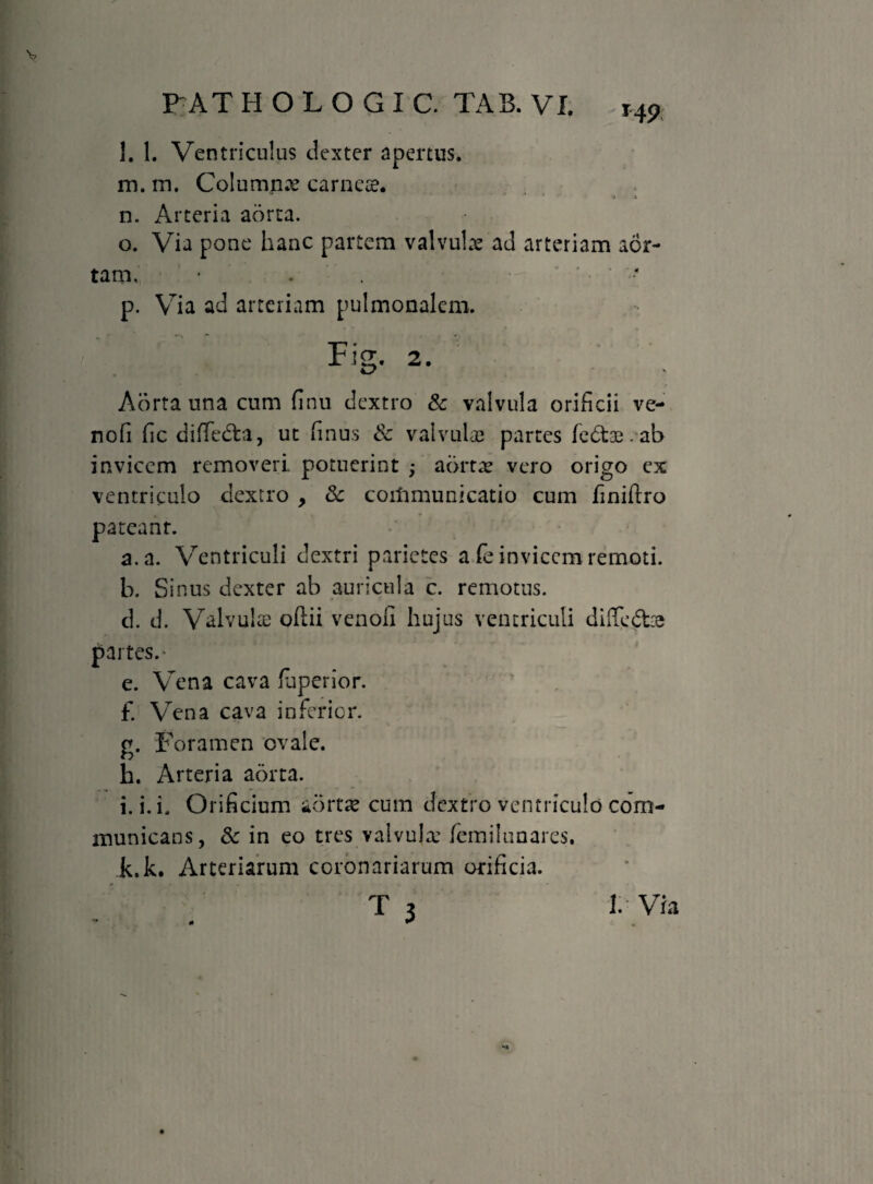 FAT HOLOGIC TAB. VI. H9 l. 1. Ventriculus dexter apertus. m. m. Columna carnete. •» i n. Arteria aorta. o. Via pone hanc partem valvulae ad arteriam aor¬ tam. • . • p. Via ad arteriam pulmonalem. Fi2. 2. Aorta una cum finu dextro & valvula orificii ve- nofi fic diffedta, ut finus & valvulae partes fedtae. ab invicem removeri potuerint ; aortae vero origo ex ventriculo dextro , Sc coilimunicatio cum finiftro pateanr. a. a. Ventriculi dextri parietes a fe invicem remoti. b. Sinus dexter ab auricula c. remotus. d. d. Valvulae oftii venoli hujus ventriculi diffe&ie partes.* e. Vena cava fuperior. f. Vena cava inferior. g. Foramen ovale. h. Arteria aorta. i. i. i. Orificium aortae cum dextro ventriculo com¬ municans, Sc in eo tres valvula: lemilunares. k.L Arteriarum coronariarum orificia. T 3 1. Via