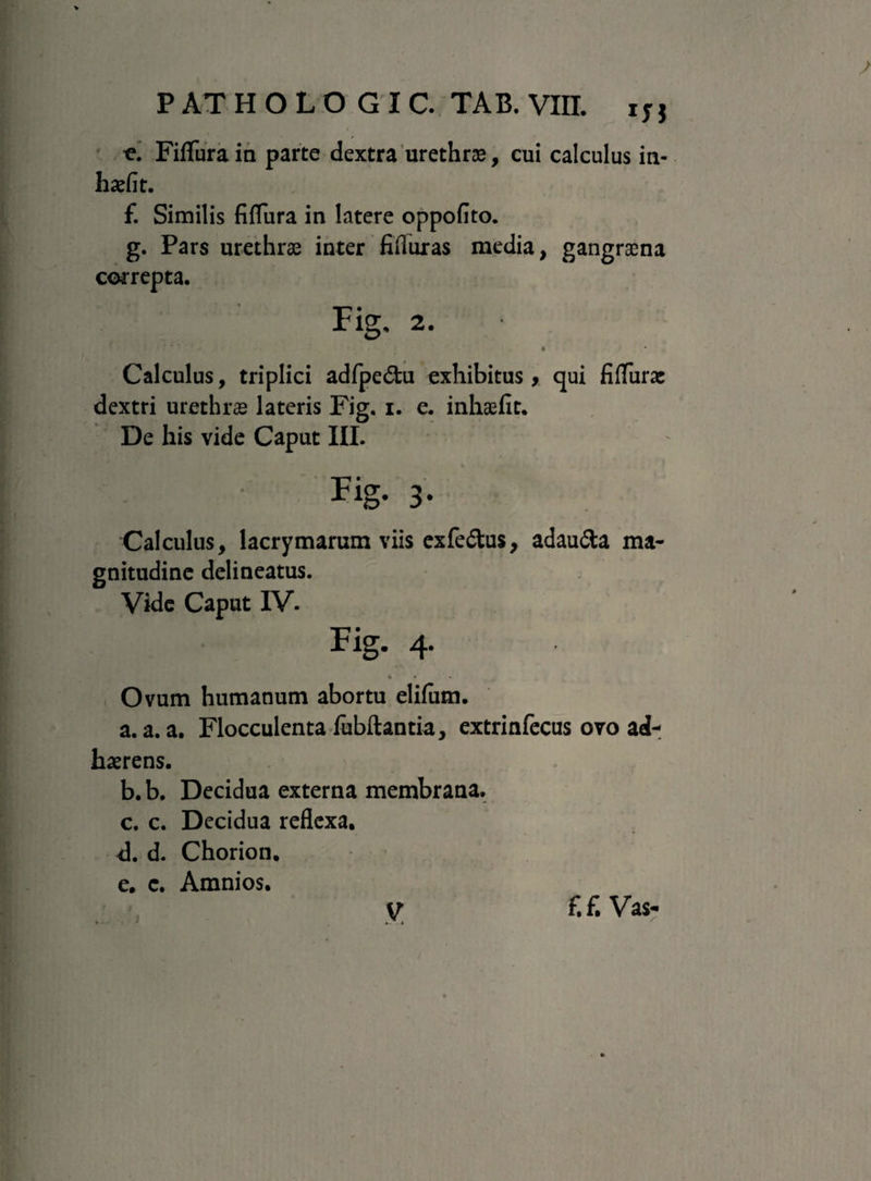 Fiffura ia parte dextra urethrae, cui calculus in- haefit. £ Similis fiflura in latere oppoflto. g. Pars urethrae inter filluras media, gangraena correpta. Fig, 2. • Calculus, triplici adfpe&u exhibitus, qui fUTurae dextri urethrae lateris Fig. i. e. inhaefit. De his vide Caput III. Fig- 3- Calculus, lacrymarum viis exfedus, adau&a ma¬ gnitudine delineatus. Vide Caput IV. Fig. 4. Ovum humanum abortu elifiim. a. a. a. Flocculenta fubftantia, extrinfecus ovo ad¬ haerens. b. b. Decidua externa membrana. c. c. Decidua reflexa. <1. d. Chorion. e. c. Amnios. J f. f. Vas- V . 4