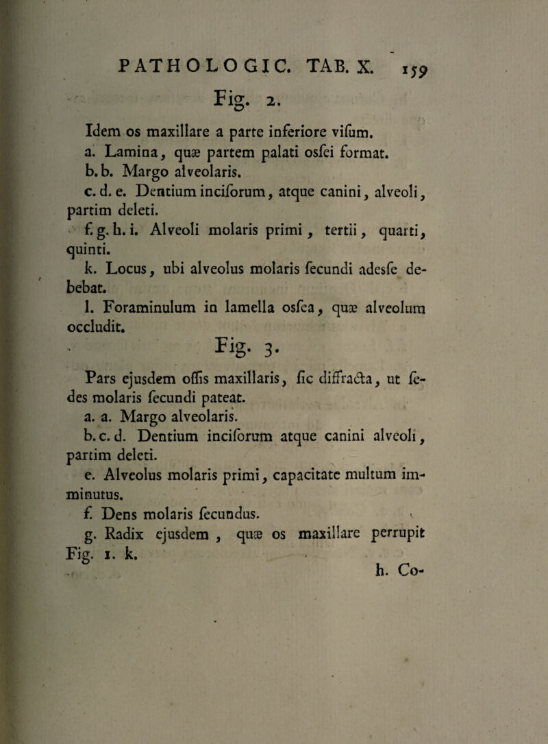 Fig. 2. Idem os maxillare a parte inferiore vifum, a. Lamina, quae partem palati osfei format. b. b. Margo alveolaris. c. d. e. Dentium inciforum, atque canini, alveoli, partim deleti. £ g. h. i. Alveoli molaris primi, tertii, quarti, quinti. k. Locus, ubi alveolus molaris fecundi adesfe de¬ bebat. l. Foraminulum in lamella osfea, quoe alveolum occludit. Fig- 3- Pars ejusdem offis maxillaris, fic diffra&a, ut le- des molaris fecundi pateat. a. a. Margo alveolaris. b. c.d. Dentium inciforum atque canini alveoli, partim deleti. e. Alveolus molaris primi, capacitate multum im¬ minutus. £ Dens molaris fecundus. g. Radix ejusdem , qu& os maxillare perrupit Fig. i. k. h. Co-