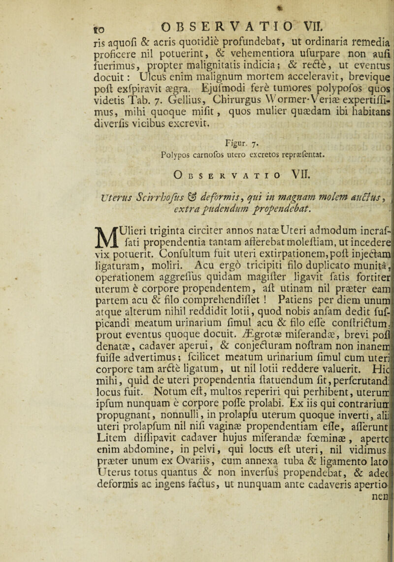 * to OBSERVATIO VII. ris aquofi & acris quotidie profundebat, ut ordinaria remedia proficere nil potuerint, & veheinentiora ufurpare non aufi luerimus, propter malignitatis indicia; & rede, ut eventus docuit: Ulcus enim malignum mortem acceleravit, brevique poft exfpiravit aegra. Ejufmodi fere tumores polypofos quos videtis Tab. 7. Gellius, Chirurgus Wormer-Veriae expertifli- mus, mihi quoque mifit, quos mulier quaedam ibi habitans diverfis vicibus excrevit. Figur. 7. Polypos carnofos utero excretos repraefentat. 1 Observatio VII. Uterus Scirrhofus & deformis, qui in magnam molem auctus, extra pudendum propendebat. MUlieri triginta circiter annos nataeUteri admodum incraf- fati propendentia tantam afferebat moleffiam, ut incedere! vix potuerit. Confultum fuit uteri extirpationem,poft injedam ligaturam, moliri. Acu ergo tricipiti filo duplicato munita, operationem aggrelTus quidam magifter ligavit fatis fortiter uterum e corpore propendentem, aft utinam nil praeter eam. partem acu & filo comprehendiflet ! Patiens per diem unumi atque alterum nihil reddidit lotii, quod nobis anfam dedit lul- picandi meatum urinarium fimul acu & filo effe conffridum; prout eventus quoque docuit. Aigrotae miferandse, brevi pofl denatffi, cadaver aperui, & conjefluram noftram non inanem fuifie advertimus; fcilicet meatum urinarium fimul cum uteris corpore tam ardle ligatum, ut nil lotii reddere valuerit. Hic: mihi, quid de uteri propendentia ftatuendum fit,perfcrutand;: locus fuit. Notum eff, multos reperiri qui perhibent, uterum ipfum nunquam e corpore poffe prolabi. Ex iis qui contrarium) propugnant, nonnulli, inprolapfu uterum quoque inverti, alii uteri prolapfum nil nifi vaginas propendentiam effe, afferunt Litem diffipavit cadaver hujus miferandse foeminae, aperte enim abdomine, in pelvi, qui locus eff uteri, nil vidimus ) praeter unum ex Ovariis, cum annexa tuba & ligamento lato . Uterus totus quantus & non inverfus propendebat, & adec | deformis ac ingens fadus, ut nunquam ante cadaveris apertio^ nent