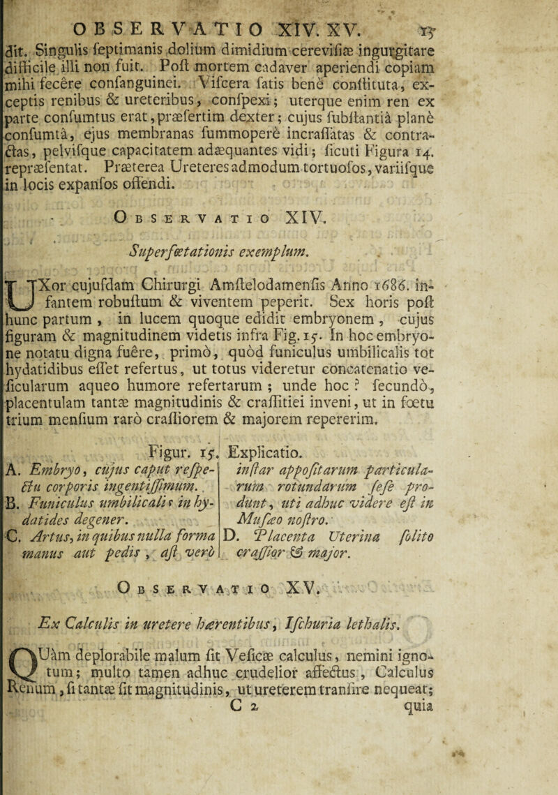 dit. Singulis feptimanis dolium dimidium cerevifiae ingurgitare difficile illi non fuit. Poft mortem cadaver aperiendi copiam mihi fecere confanguinei. Vifcera fatis bene conftituta, ex¬ ceptis renibus & ureteribus, confpexi ; uterque enim ren ex parte confumtus erat,praeferdm dexter; cujus fubftantia plane confumta, ejus membranas fummopere incraflatas & contra- ftas, pelvifque capacitatem adaequantes vidi; ficuti Figura 14. repraefentat. Praeterea Ureteres admodum tortuofos, variifque in locis expanfos offendi. • Observatio XIV. ® ** ' Superf(stationis exemplum. UX01* cujufdam Chirurgi Amftelodamenfis Anno 1686. in¬ fantem robuitum & viventem peperit. Sex horis poft hunc partum , in lucem quoque edidit embryonem , cujus figuram & magnitudinem videtis infra Fig. 15-. In hoc embryo¬ ne notatu digna fuere, primo, quod funiculus umbilicalis tot hydatidibus effet refertus, ut totus videretur concatenatio ve- ficularum aqueo humore refertarum ; unde hoc ? fecundo, placentulam tantae magnitudinis & craflitiei inveni, ut in foetu trium menfium raro crafliorem & majorem repererim. Figur. if. A. Embryo, cujus caput refpe- £lu corporis ingentijfimum.. B. Funiculus umbilicali r in hy- datides degener. C. Artus jn quibus nulla forma manus aut pedis , ^ ajl verp Explicatio. inftar appojitarum particula¬ rum rotundarum fefe pro¬ dunt , uti adhuc videre eji in Mufao noflror D. FI acent a Uterina folito crajjior & major. \ Observatio XV. Ex Calculis in uretere harentibus, Ifchuria lethalis. QUkn deplorabile malum fit Veficae calculus, nemini igno¬ tum ; multo tamen adhuc crudelior affedus, Calculus Kenum, fi tantse fit magnitudinis, ut ureterem tranfire nequeat; jlii .r •. ' • C % quia