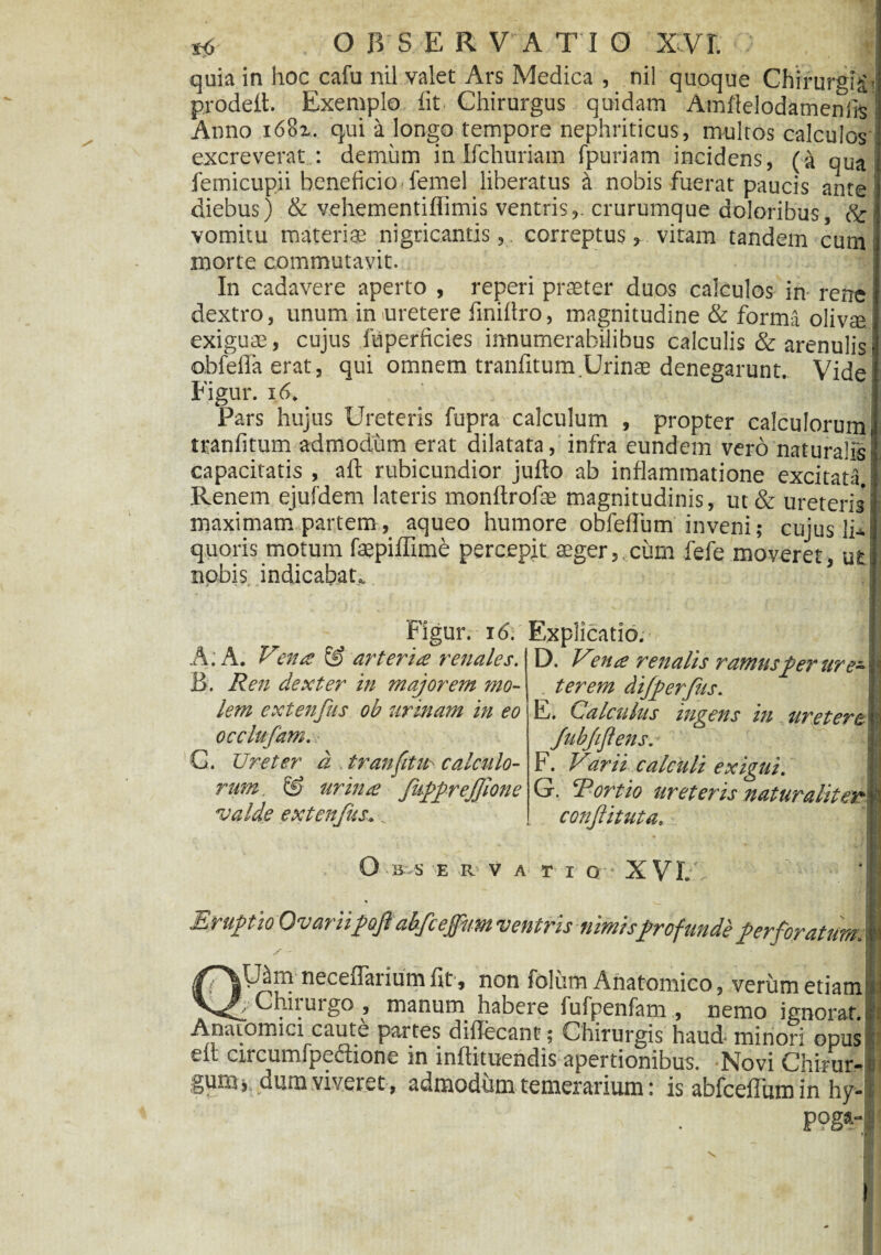 quia in hoc cafu nil valet Ars Medica , nil quoque Chirurgis > prodelt. Exemplo fit Chirurgus quidam Amffelodamenfis Anno i68z. qui a longo tempore nephriticus, multos calculGs excreverat.: demum in Ifchuriam fpuriam incidens, (a qua femicupii beneficio femel liberatus S nobis fuerat paucis ante diebus) & vehementiffimis ventris,, crurumque doloribus, & vomitu materiae nigricantis, correptus, vitam tandem cum i morte commutavit. In cadavere aperto , reperi praeter duos calculos in rene dextro, unum in uretere finiflro, magnitudine & forma olivae exiguae, cujus fuperficies innumerabilibus calculis & arenulis obfellaerat, qui omnem tranfitum Urinae denegarunt. Vide Figur. 16. Pars hujus Ureteris fupra calculum , propter calculorum i tranfitum admodum erat dilatata, infra eundem vero naturalis capacitatis , afl rubicundior juflo ab inflammatione excitata. Renem ejufdem lateris monftrofae magnitudinis, ut& ureteris maximam partem, aqueo humore obfeffum inveni; cujus li* quoris motum faepiffime percepit aeger,.curn fefe moveret, ut nobis indicabat,. Figur. 16. Explicatio D A; A. V'ena & arteria renales. B. Ren dexter in majorem mo¬ lem extenfus ob urinam in eo occlufam. G. Ureter d tranfitu calculo¬ rum & urina fkffrejjlone valde extenfus D. Vena renalis ramus fer ure~ terem differfeis. E. Calculus ingens in uretere fubfjlens. F. Varii calculi exigui. G. Rortio ureteris conjlituta. O B S E R»V ATI Q XVL % Eruptio Ovariipoft abfcejfum ventris nimisprofunde perforatum. iUam necefiarium fit, non folum Anatomico, verum etiam Chirurgo , manum habere fufpenfam , nemo ignorat. Anatomici caute partes diflecant; Chirurgis haud minori opus elt circumfpeflione in inftituendis apertionibus. Novi Chirur¬ gum j dum viveret , admodum temerarium: is abfcefTum in hy- P°ga- I V