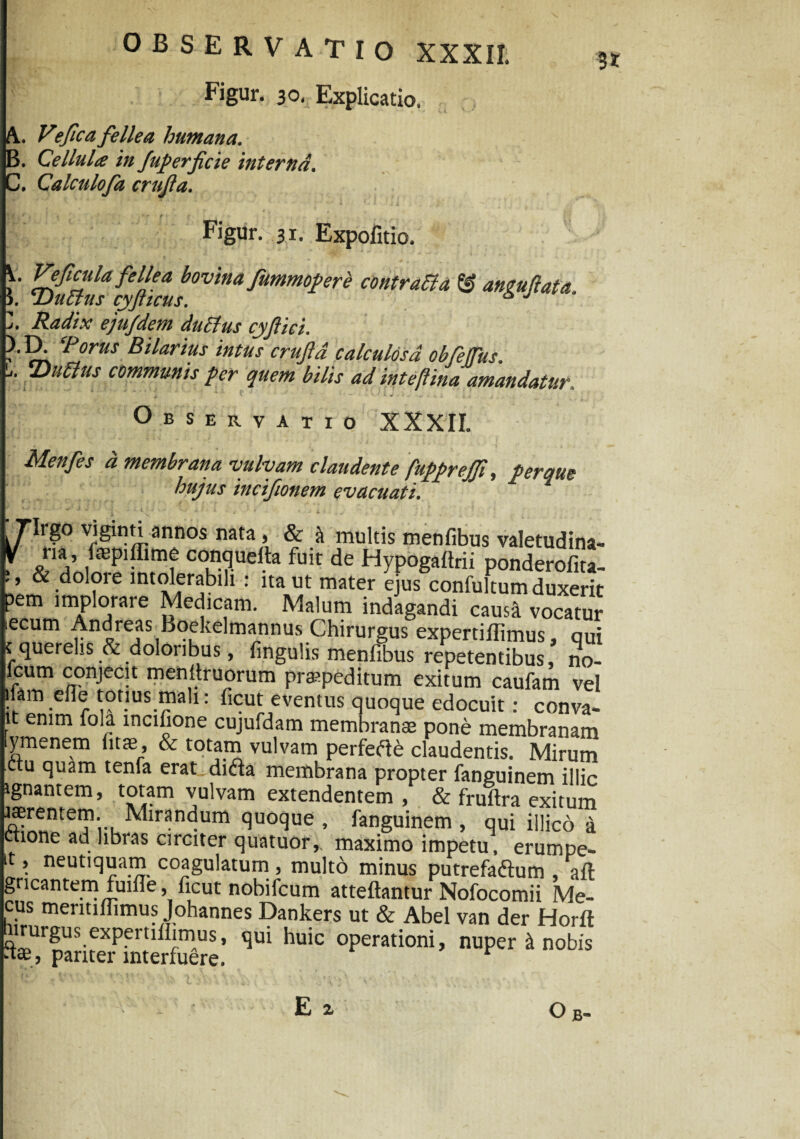 Figur. 30, Explicatio, 3* A. Vfica fellea humana. B. Cellula in fuperficie interna. . Calculofz crujia. Figur. 3,1. Expolitio. V. Veftcula fellea bovina fummopere contraBa & ane uflat a l. DuBus cyfticus. 5 J Z. Radix ejufdem duBus cyjliei. ).D. ‘Porus B darius intus crujld calculosa obfeffus. . UJuBus communis per quem bilis ad inteflina amandatur. * * ' ‘ '* ' - ' ' % ' 1 * ■ '' • «. i • *- <t - J . -4k. ' k Observatio XXXII. Menfes d membrana vulvam claudente fuppreffi. peraue hujus incifionem evacuati. Tligo viginti annos nata , & & multis menfibus valetudina- ona,’ conquelta fuit de Hypogaftrii ponderofita- & doloie intolerabili : ita ut mater ejus confultum duxerit pem implorare Medicam. Malum indagandi causa vocatur ecum Andreas Boekelmannus Chirurgus expertiflimus, qui t querelis & doloribus, fingulis menfibus repetentibus, no- fcum conjecit menttruorum praepeditum exitum caufam vel ifamelle tonus mali: ficut eventus quoque edocuit: conva- it enim fola mcifione cujufdam membranae pone membranam Hymenem litae, & totam vulvam perfeft& claudentis. Mirum ctu quam tenfa erat difta membrana propter fanguinem illic ignantem, totam vulvam extendentem , & fruftra exitum gerentem. Mirandum quoque , fanguinem, qui illico a ctione ad libras circiter quatuor,. maximo impetu, erumpe- it, neutiquam coagulatum, multo minus putrefaftum , aft gncantem fuifle, ficut nobifcum atteftantur Nofocomii Me- cus mentiflimus Johannes Dankers ut & Abel van der Horft irurgus expertifiimus, qui huic operationi, nuper & nobis ■t®, pariter interfuere. E O b-