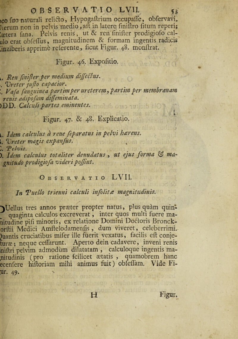 OBSERVATIO LVII. ii )CO ftro naturali relido, Hypogaftrium occupalle, obfervavi. Jterum non in pelvis medio, ait in latere fini ftro fitum reperi ieetera fana. Pelvis renis, ut & ren finifter prodigiofo cal- ulo erat obfefius, magnitudinem & formam ingentis radicis iinziberis apprimi referente, ficut Figur. 48. monflrat. Figur. 46. ■ Expofitio. Ll Ren finifter per medium dijfecius. Ureter jufto capacior. Vaja [anguinea partimper ureterem, partim per membranam renis adipofara difjeminata. )]DD. Galculi partes eminentes. i ■r;- \F 3 ■ r> ■' t i Figur. 47. & 48. Explicatio. i . ' ) .. Idem calculus a rene feparatus in pelvi hterens. ;. Ureter magis expanfus. ]. R civis. ). Idem calculus totaliter denudatus, ut ejus forma & ma¬ gnitudo prodigiofa videri pojftnt. Observatio LVII. In Rue lio trienni calculi infolitee magnitudinis. )Uellus tres annos praster propter natus, plus quam quin¬ quaginta calculos excreverat, inter quos multi fuere ma- nitudine pifi minoris, ex relatione Domini Dodoris Bronck- orftii Medici Amftelodamenfis , dum viveret, celeberrimi. )uantis cruciatibus mifer ille fuerit vexatus, facilis efl conje- turse; neque ceftarunt. Aperto dein cadavere, inveni renis iniftri pelvim admodum dilatatam , calculoque ingentis ma- ,nitudinis (pro ratione fcilicet astatis , quamobrem hanc ecenfere hiftoriam mihi animus fuit) obfeiTam. Vide Fi- ;ur. 49. H Figur. 1*“ \