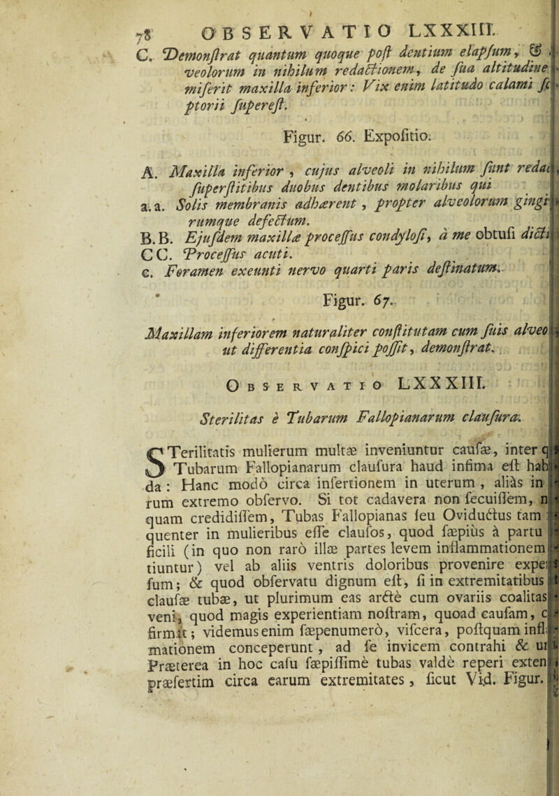 B'SERVAT'10 LX XXIII C. Dcmonftrat quantum quoque pofl dentium elapjum, & veolorum in nihilum redaFtionern-y de Jua altitudineI miferit maxilla inferior .* Vix enim latitudo calami ptorii fupereft. Figur. 66. Expofitio; A. Maxilla inferior 9 cujus alveoli in nihilum funt redat L fuperf itibus duobus dentibus molaribus qui a. a. Solis membranis adharent, propter alveolorum gingin rumque defeEtum. t r B. B. Ejufdem maxilla procejfus condyloJi9 d me obtufi diclM CC. Trocejfus acuti. ... Jj €. Foramen exeunti nervo quarti paris dejlinatum Figur. 67. Maxillam inferiorem naturaliter conftitutam cumjiiis alveoli ut differentia confffici pojjit, demonjlrat. O B S E R V A T I O L X X X 111. Sterilitas e Tubarum Falloffianarum claufura. Terilitatis mulierum multae inveniuntur caufae, inter qn ^ Tubarum Fallopianarum claufura haud infima eft hahjjij da: Hanc modo circa infertionem in uterum, aliis in i‘i rum extremo obfervo. Si tot cadavera non fecuifiem, n < quam crediditfem, Tubas Fallopianas leu Qvidudus tam fl quenter in mulieribus elTe claufos, quod faepius i partu jij ficili (in quo non raro illae partes levem infiammationemid tiuntur) vel ab aliis ventris doloribus provenire expetit' fum; & quod obfervatu dignum eft, fi in extremitatibus t claufe tubae, ut plurimum eas arde cum ovariis coalitas • veni, quod magis experientiam noftram, quoad eaufam, cli firmat; videmus enim faepenumero, vifcera, poftquam infla.; mationem conceperunt , ad fe invicem contrahi & ui i. Prsterea in hoc cafu faepiftime tubas valde reperi extenti prseferdm circa earum extremitates, ficut Vid. Figur. l