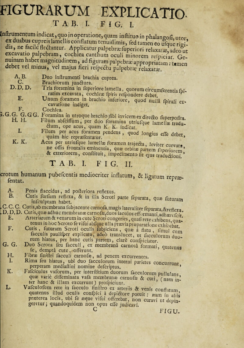 FIGURARUM EXPLICATIO. T A B. I. F I G. I. Inftrumentum indicat, quo in operatione, quam inftituoin phalangofi utor ex duabus cupreis lamellis conflatum tenuiffimis, fed tamen eo ufque risi-’ dis, ne facile flcdantur. Applicatur palpebraefuperiori relaxat*, adeo ut excavatio palpebram, cochlea canthum oculi minorem relpiciat Ge numam habet magnitudinem, ad figuram palpebraeappropriatam: tamen debet vel minus, vel majus fieri reipe&u palpebrte relaxata. Duo inftrumenti brachia cuprea. Brachiorum jun&ura. Tria foramina in fuperiore lamella, quorum circumferentiafni- ratim excavata, cochleae fpiris refpondere debet p‘ Unum foramen in brachio inferiore, quod nulia fpirali er. cavatione indiget. r Cochlea. i.G.G. G.GG. Foramina in utroque brachio ifibi invicem exdiredo fuperpofita. H. H. Filum abfciffum, per duo foramina utriufque lamclke tradu- clum, ope acus, quam K. K. indicat. Filum per acus foramen pendens , quod iongius effe debet quam hic repraefentarur. 6 Acus per utriufque lamel te foramen trajeda, leviter curvata ne offis frontalis eminentia, qua; orbit* partem fuperiorem & exteriorem, conffituit, impedimento iit ejus tradudlioni. T A B. I. F I G. II. crotum humanum pubefeentis mediocriter inflatum, & ligatum re di— fentat. a t A. B. C. D.D, D. E. F. I. K. K. A. Penis flaccidus, ad pofleriora reflexus. B. Cutis furfum reflexa, & in illa Scroti parte feparata, qua: futuram infculptam habet. ’ rdni K C- C. C. Cutis,ab membrana fubjacente carnofa,magis Iateraliter feparata &reflexa LD.D.D. Cutis,quae adhuc membranae carnofas,duos faculosefFurmanti adhaere frit* E. Arteriarum & venarum in cute Scroti congeries, quali rete exhibens qua-* tenus in hoc Scroto fe vifui abfque ulla praevia praeparatione exhibebat F. Cutis, futuram Scroti oculis fubjiciens , quae a flatu, iimu! cum faeculis paulifper explicata, adeo translucet, ut facculorum duo rum hiatus, per hanc cutis partem, clare confpiciatur. G. G. Duo Scrota feu facculi , ex membrana carnosa formati' ouqtennc fe, dempta cute, offerunt. ’ 1 uus H. Fibrae liniflri facculi carnofae, ad penem excurrentes. I. Rima feu hiatus, ubi duo facculorum interni parietes concurrunt perperam mediaftini nomine deferiptus. ’ K. Fafciculus vaforum, per interftitium duorum facculorum pullulans quae varie difleminata vafa membrana: carnofe & cuti (nam ,„I ter hanc & illam excurrunt) profpiciunt. ’ ' L. Vafculofum rete in facculo finiflro ex arteriis & venis conflatum quatenus illud oculis confpici a depidore potuit; „am in aliis prsterea locis, ubi fe «que vifui offerebat, non curavi ut depin¬ geretur; quandoquidem non opus effe judicavi. C FIGU-