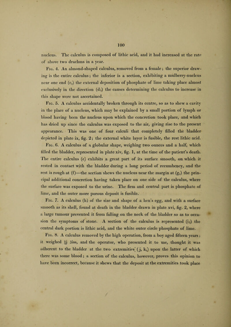 nucleus. The calculus is composed of litbic acid, and it had increased at the rate of above two drachms in a year. Fig. 4. An almond-shaped calculus, removed from a female; the superior draw¬ ing is the entire calculus; the inferior is a section, exhibiting a mulberry-nucleus near one end (c,) the external deposition of phosphate of lime taking place almost exclusively in the direction (d;) the causes determining the calculus to increase in this shape were not ascertained. Fig. 5. A calculus accidentally broken through its centre, so as to shew a cavity in the place of a nucleus, which may be explained by a small portion of lymph or blood having been the nucleus upon which the concretion took place, and which has dried up since the calculus was exposed to the air, giving rise to the present appearance. This was one of four calculi that completely filled the bladder depicted in plate ix, fig. 2; the external white layer is fusible, the rest lithic acid. Fig. 6. A calculus of a globular shape, weighing two ounces and a half, which filled the bladder, represented in plate xiv, fig. 1, at the time of the patient’s death. The entire calculus (e) exhibits a great part of its surface smooth, on which it rested in contact with the bladder during a long period of recumbency, and the rest is rough at (f)—the section shews the nucleus near the margin at (g,) the prin¬ cipal additional concretion having taken place on one side of the calculus, where the surface was exposed to the urine. The firm and central part is phosphate of lime, and the outer more porous deposit is fusible. Fig. 7. A calculus (h) of the size and shape of a hen’s egg, and with a surface smooth as its shell, found at death in the bladder drawn in plate xvi, fig. 2, where a large tumour prevented it from falling on the neck of the bladder so as to occa¬ sion the symptoms of stone. A section of the calculus is represented (i;) the central dark portion is lithic acid, and the white outer circle phosphate of lime. Fig. 8. A calculus removed by the high operation, from a boy aged fifteen years ; it weighed gj 3iss, and the operator, who presented it to me, thought it was adherent to the bladder at the two extremities (j, k,) upon the latter of which there was some blood; a section of the calculus, however, proves this opinion to have been incorrect, because it shews that the deposit at the extremities took place