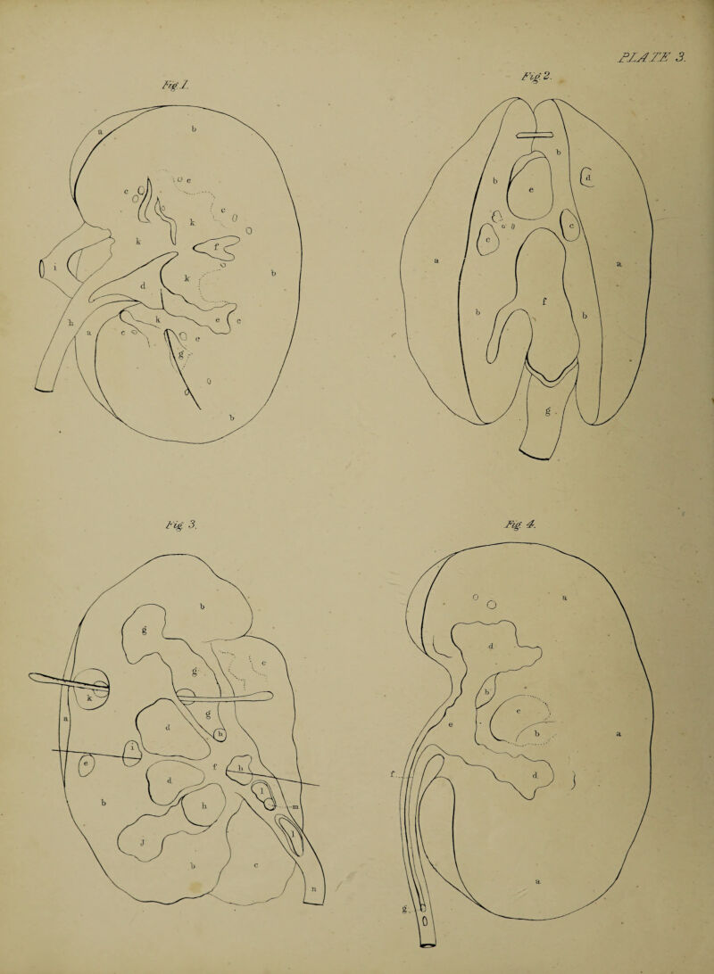 I' eg. 3. Fig. 4.