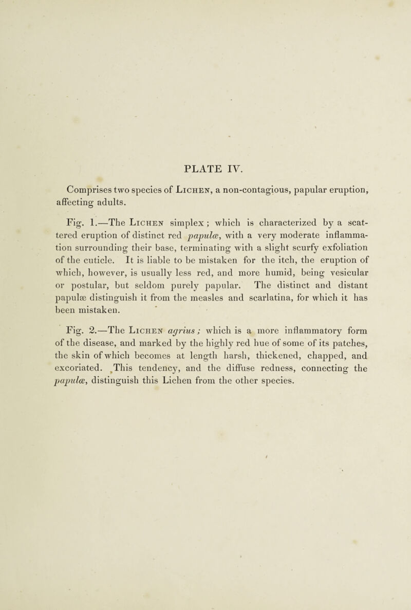 Comprises two species of Lichen, a non-contagious, papular eruption, affecting adults. Fig. 1. —The Lichen simplex; which is characterized by a scat¬ tered eruption of distinct red papula, with a very moderate inflamma¬ tion surrounding their base, terminating with a slight scurfy exfoliation of the cuticle. It is liable to be mistaken for the itch, the eruption of which, however, is usually less red, and more humid, being vesicular or postular, but seldom purely papular. The distinct and distant papulae distinguish it from the measles and scarlatina, for which it has been mistaken. Fig. 2.—The Lichen agrius; which is a more inflammatory form of the disease, and marked by the highly red hue of some of its patches, the skin of which becomes at length harsh, thickened, chapped, and excoriated. This tendency, and the diffuse redness, connecting the papula, distinguish this Lichen from the other species.