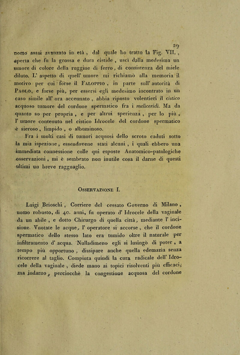 nomo assai avanzato in età , dal quale ho tratto la Fig. VII. , s aperta che fu la grossa e dura cistide , usci dalla medesima un umore di colore della ruggine di ferro , di consistenza del miele diluto. L’ aspetto di queir umore mi richiamò alla memoria il motivo per cui Torse il Fàloppio , in parte sull’ autorità di Paolo, e forse più, per essersi egli medesimo incontrato in un caso simile all’ora accennato , abbia riposto volentieri il cistico acquoso tumore del cordone spermatico fra i mcliceridi. Ma da quanto so per propria , e per altrui sperienza , per lo più , F umore contenuto nel cistico Idrocele del cordone spermatico è sieroso , limpido , o albuminoso. Fra i molti casi di tumori acquosi dello scroto caduti sotto la mia ispezione , essendovene stati alcuni , i quali ebbero una immediata connessione colle qui esposte Anatomico-patologiche osservazioni, mi è sembrato non inutile cosa il darne di questi ultimi un breve ragguaglio, t ' , Osservazione I. Luigi Brioschi , Corriere del cessato Governo di Milano 9 uomo robusto, di 40. anni, fu operato dT Idrocele della vaginale da un abile , e dotto Chirurgo di quella città, mediante F inci¬ sione. Vuotate le acque, F operatore si accorse , che il cordone spermatico dello stesso lato era tumido oltre il naturale per infiltramento d’ acqua. Nulladimeno egli si lusingò di poter , a tempo più opportuno , dissipare anche quella edemazìa senza ricorrere al taglio. Compiuta quindi la cura radicale dell’ Idro¬ cele della vaginale , diede mano ai topici risolventi più efficaci; ma indarno ^ perciocché la congestione acquosa del cordone
