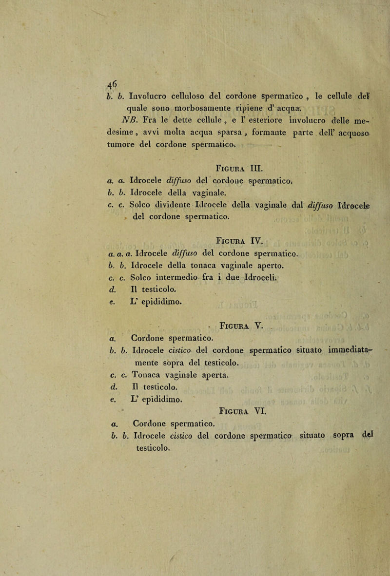 b. b. Involucro celluloso del cordone spermatico , le cellule del quale sono morbosamente ripiene d’ acqua. NB. Fra le dette cellule , e 1’ esteriore involucro delle me¬ desime , avvi motta acqua sparsa , formante parte dell’ acquoso tumore del cordone spermatico. Figura III. ù. a. Idrocele diffuso del cordone spermatico. h. b. Idrocele della vaginale. c. c. Solco dividente Idrocele della vaginale dal diffuso Idrocele del cordone spermatico. Figura IV. a. a. a. Idrocele diffuso del cordone spermatico. b. b. Idrocele della tonaca vaginale aperto. c. c. Solco intermedio fra i due Idroceli; d. Il testicolo. &lt;?. L’ epididimo. - Figura V. a. Cordone spermatico. b. b. Idrocele cistico del cordone spermatico situato immediata¬ mente sopra del testicolo. c. c. Tonaca vaginale aperta. d. Il testicolo. e. L’ epididimo. Figura VI. a. Cordone spermatico. b. b. Idrocele cistico del cordone spermatico situato sopra del testicolo.