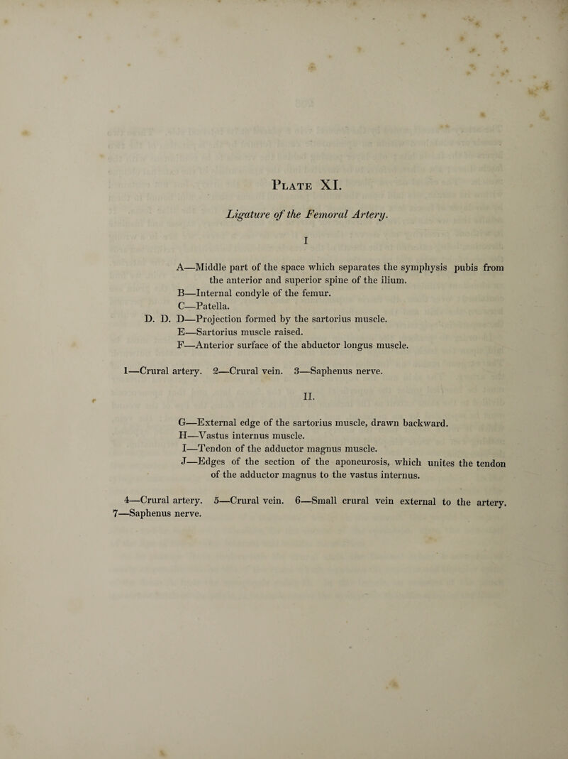 Ligature of the Femoral Artery. I A—Middle part of the space which separates the symphysis pubis from the anterior and superior spine of the ilium. B—Internal condyle of the femur. C—Patella. D. D. D—Projection formed by the sartorius muscle. E—Sartorius muscle raised. F—Anterior surface of the abductor longus muscle. 1—Crural artery. 2—Crural vein. 3—Saphenus nerve. II. G—External edge of the sartorius muscle, drawn backward. H—Vastus internus muscle. I—Tendon of the adductor magnus muscle. J—Edges of the section of the aponeurosis, which unites the tendon of the adductor magnus to the vastus internus. 4—Crural artery. 5—Crural vein. 6—Small crural vein external to the artery. 7—Saphenus nerve.